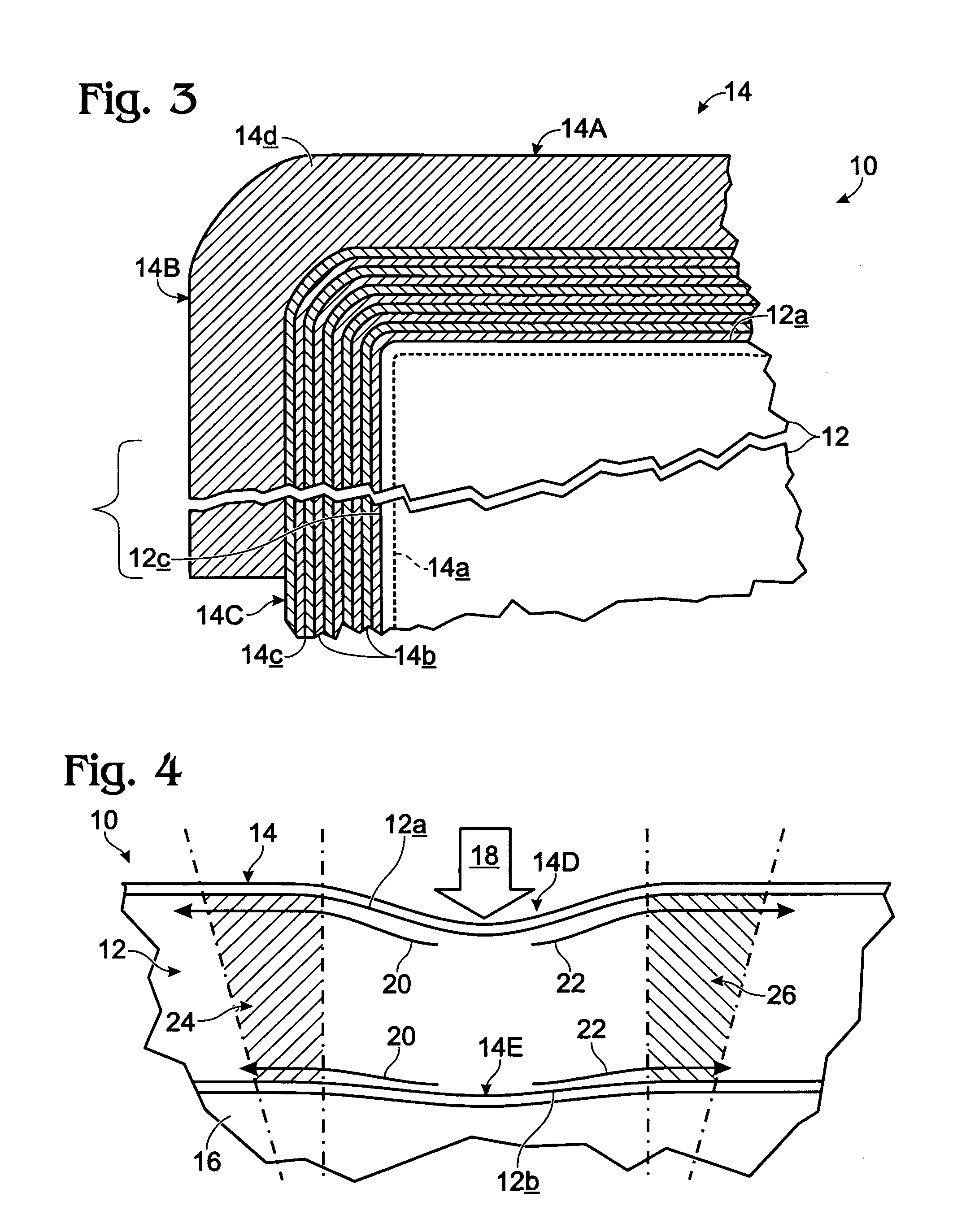 Anatomical, pressure-evenizing mattress overlay and associated methodology