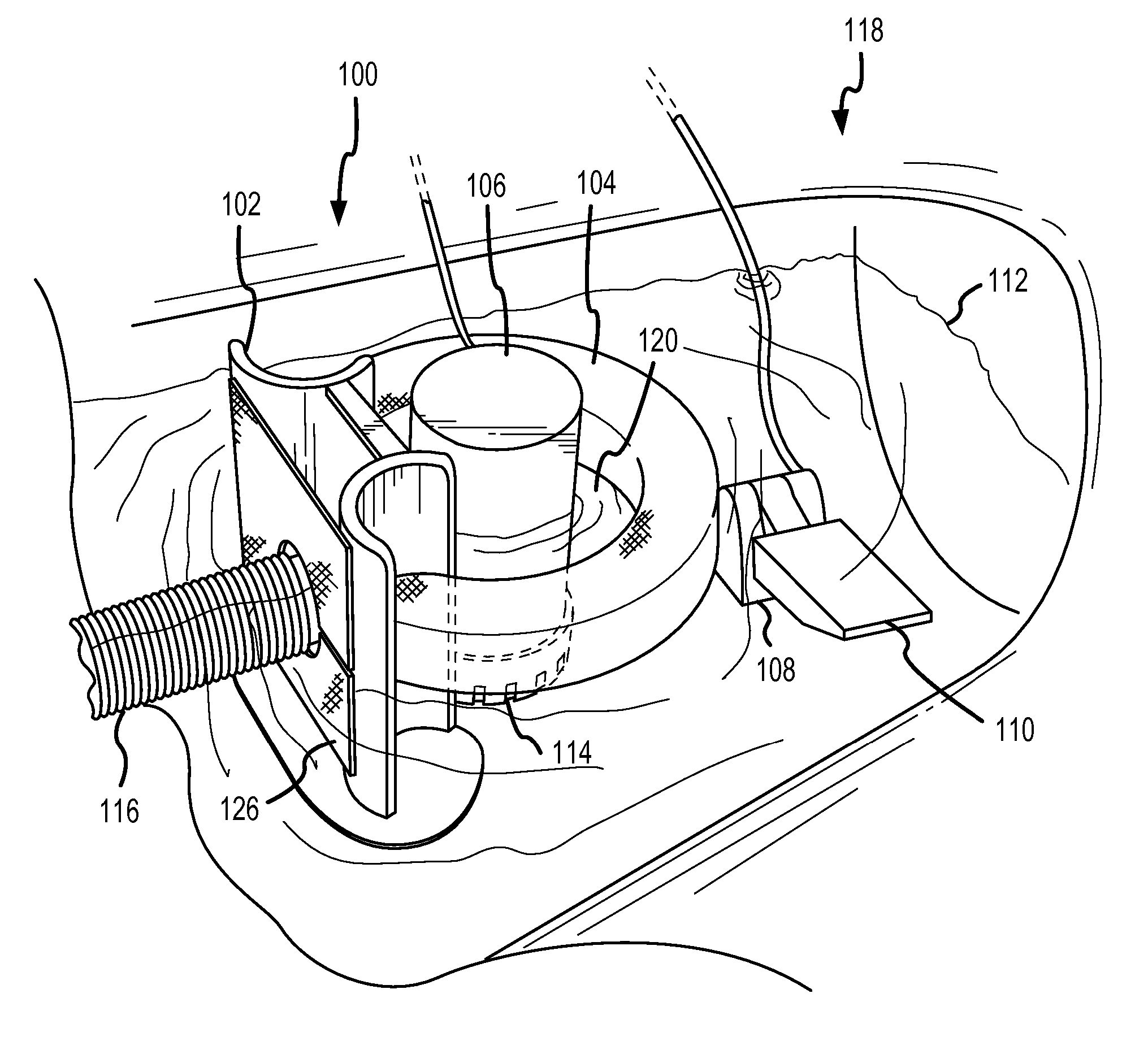 Water Pollution Prevention And Remediation Apparatus