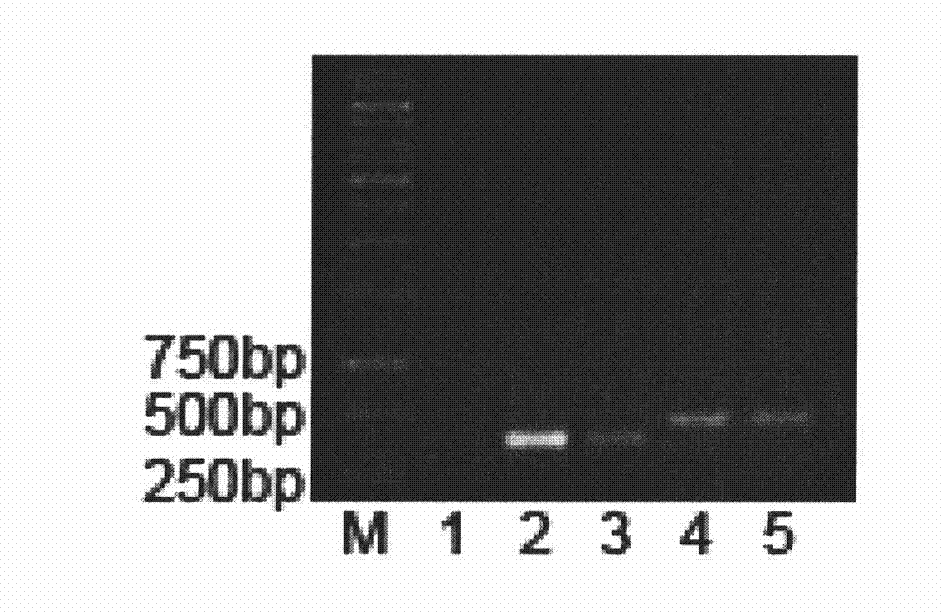 Method for expressing recombinant human bone morphogenetic protein in insect cell