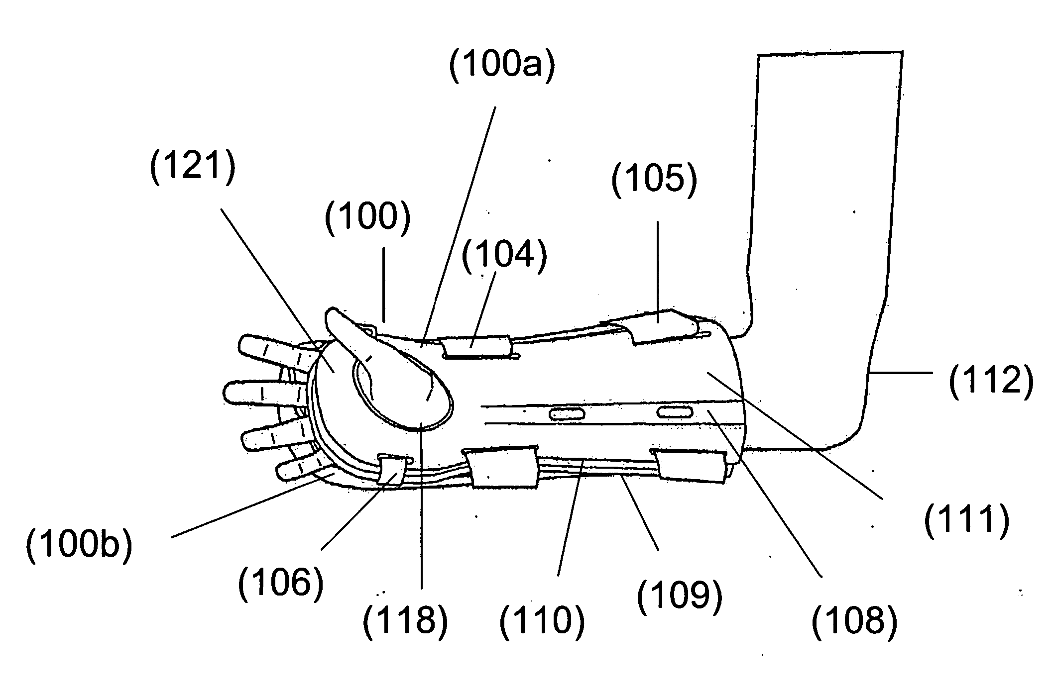 Fracture brace