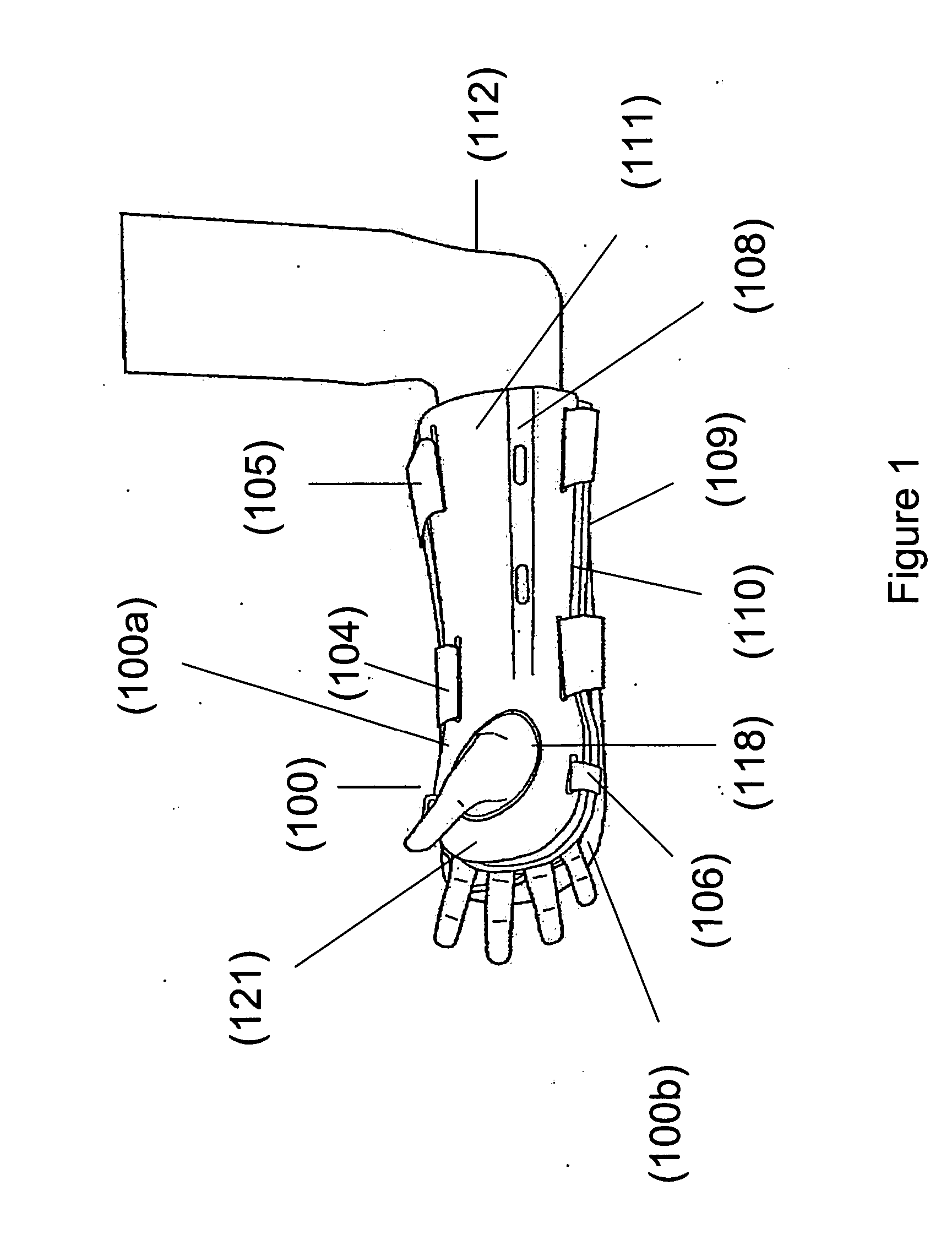 Fracture brace