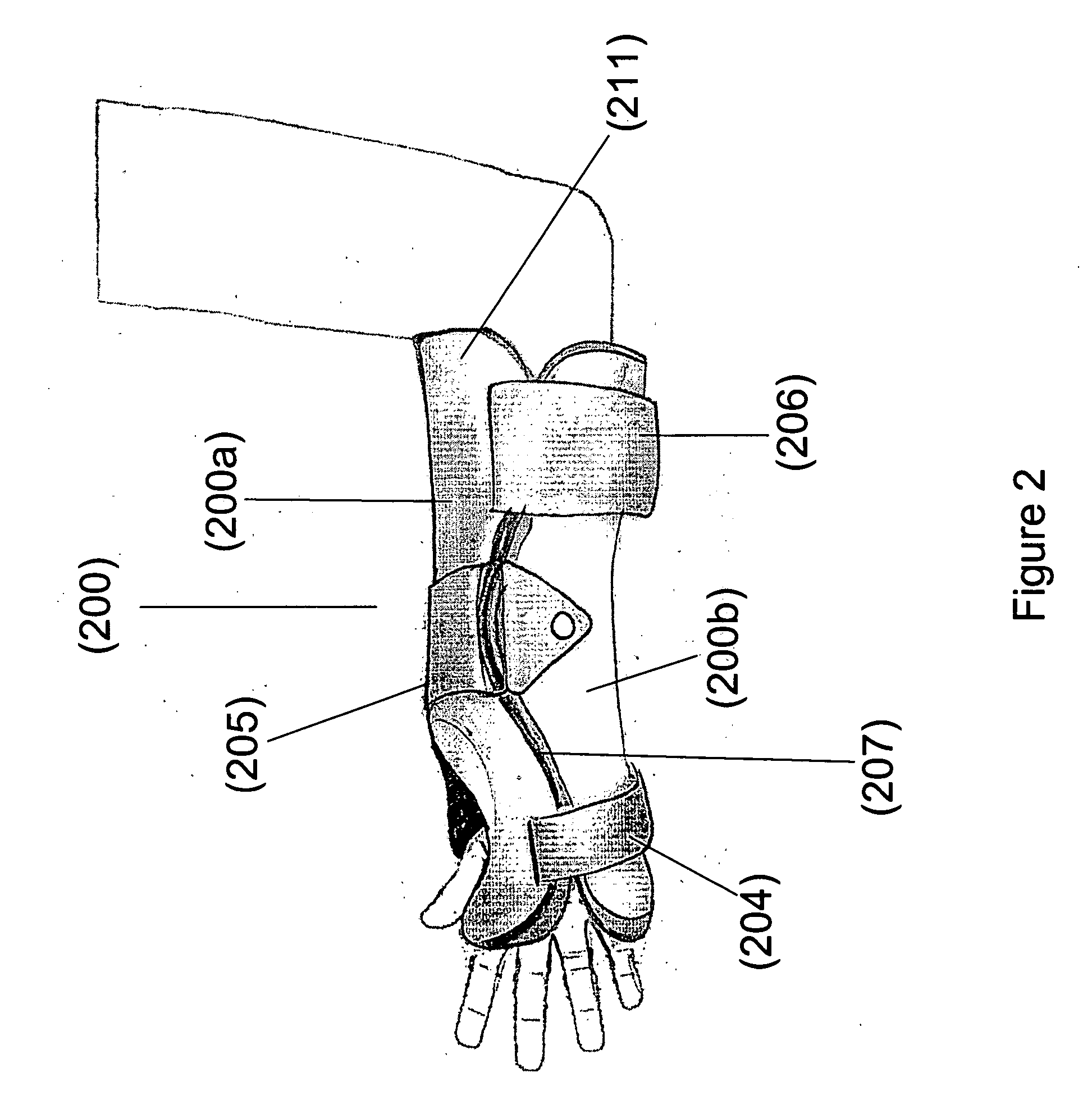 Fracture brace