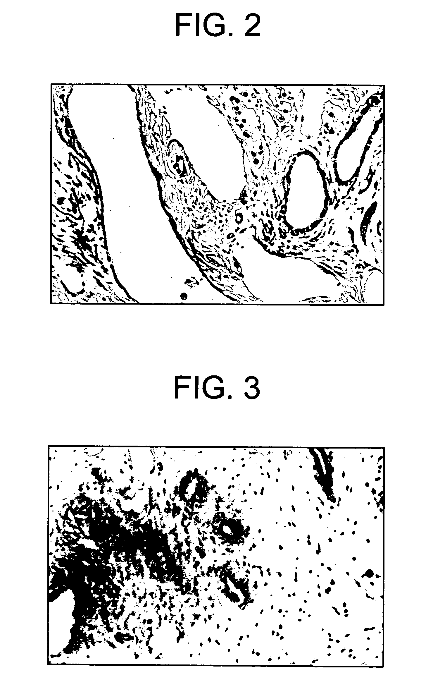 Intratesticular injection of chemical sterilant