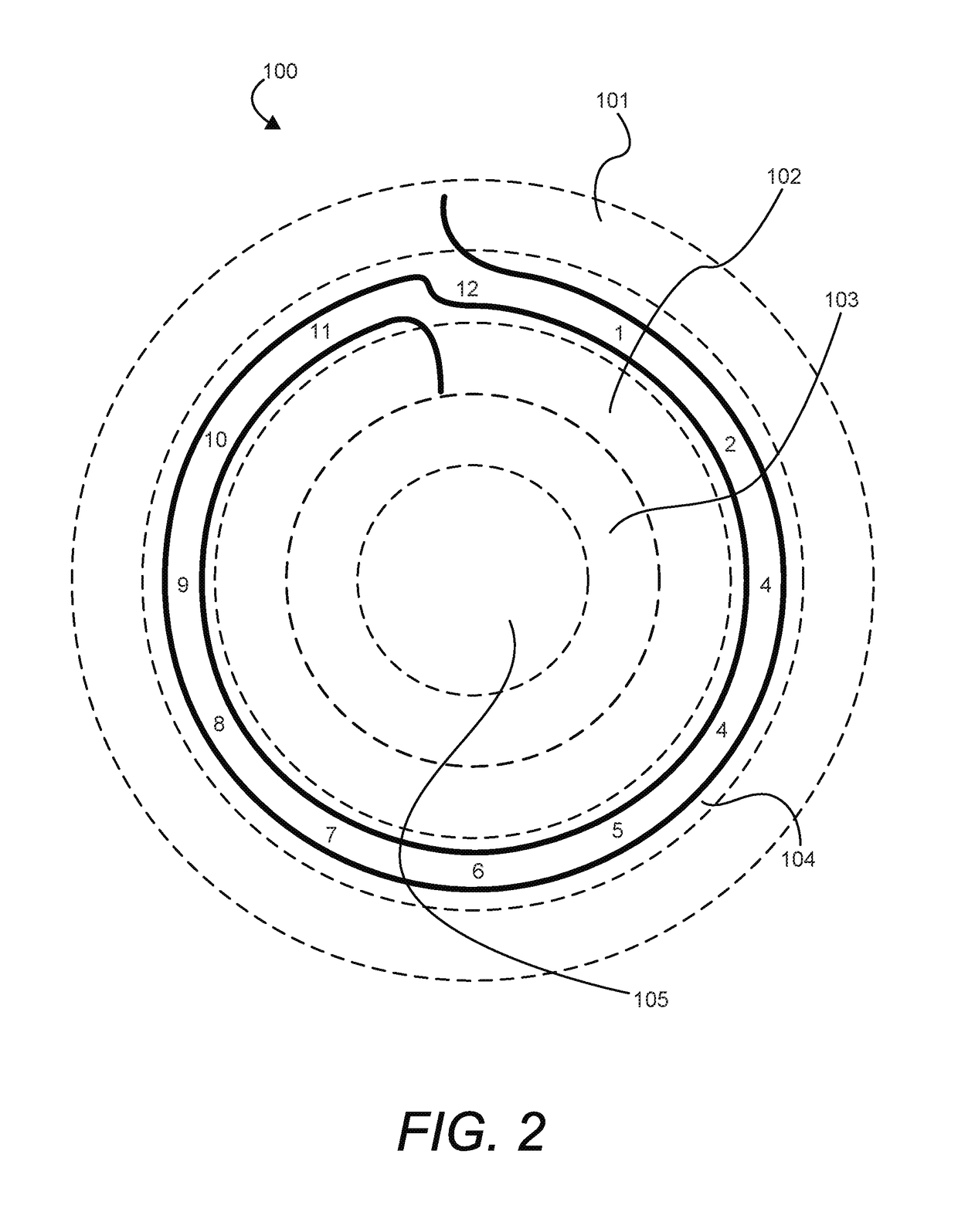 Electrical time measuring system or device indicating time intervals by regioned concentric arciforms that indicate the time of duration of particular events