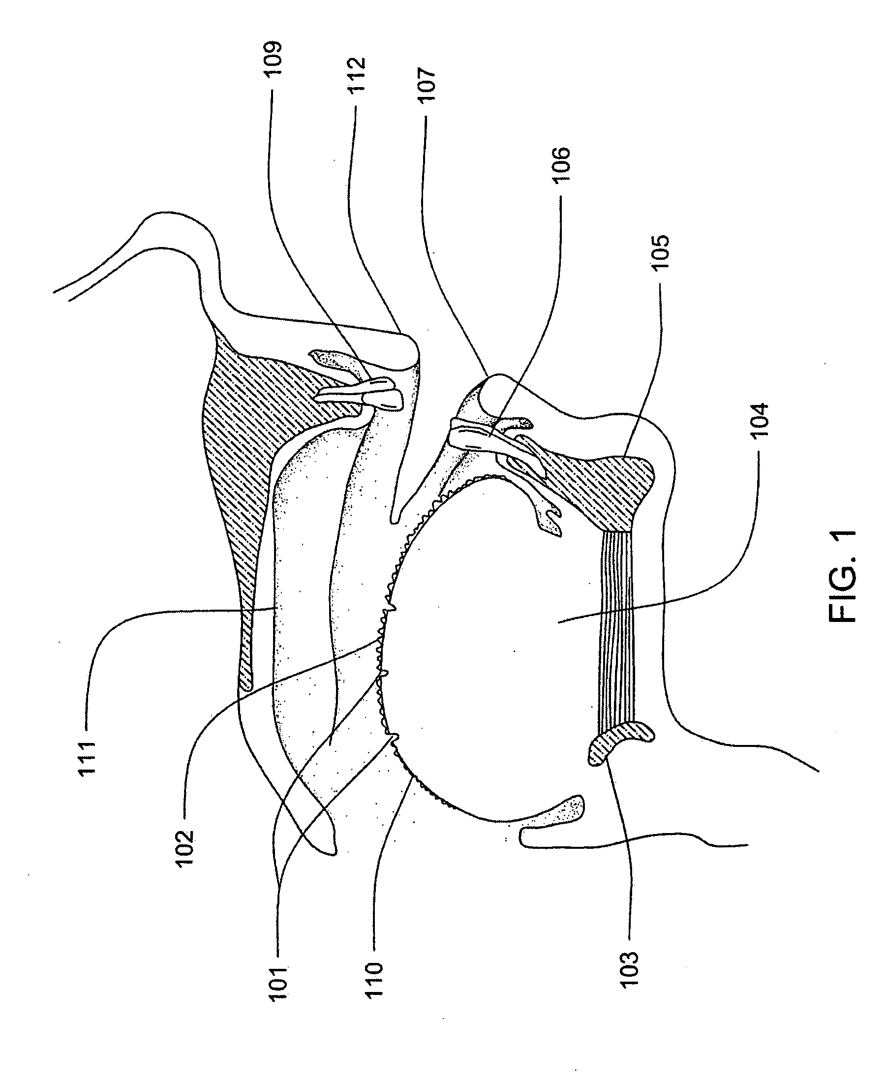 Tongue cleaning device