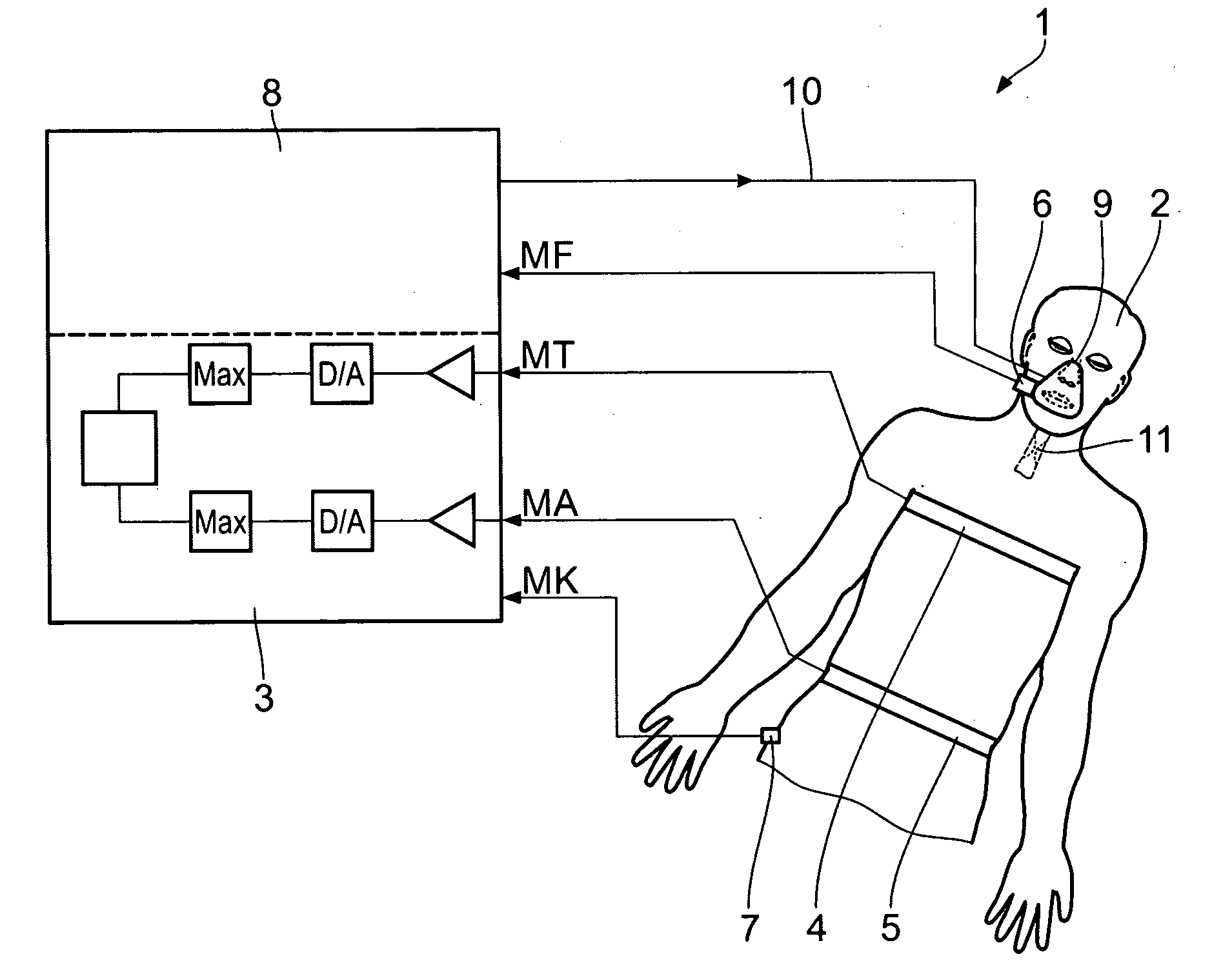 Method and apparatus for respiratory monitoring