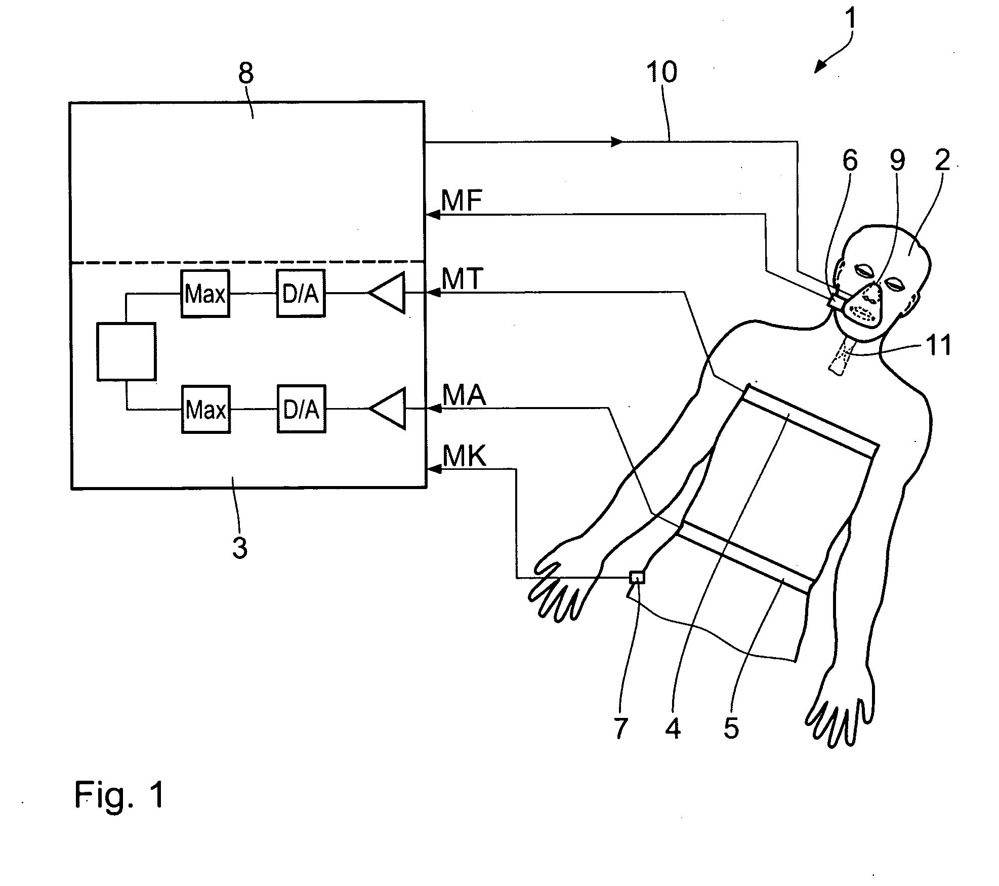 Method and apparatus for respiratory monitoring