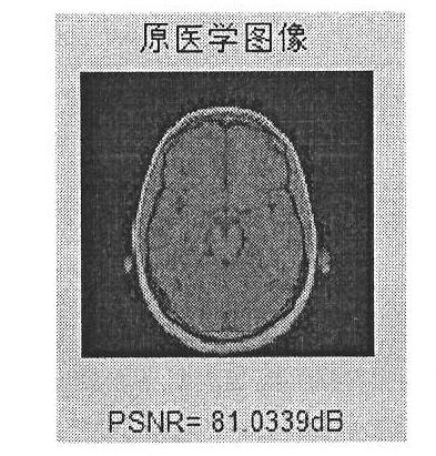 Geometric-attack-resistible medical-image multiple-watermark method based on DFT (Discrete Fourier Transform)