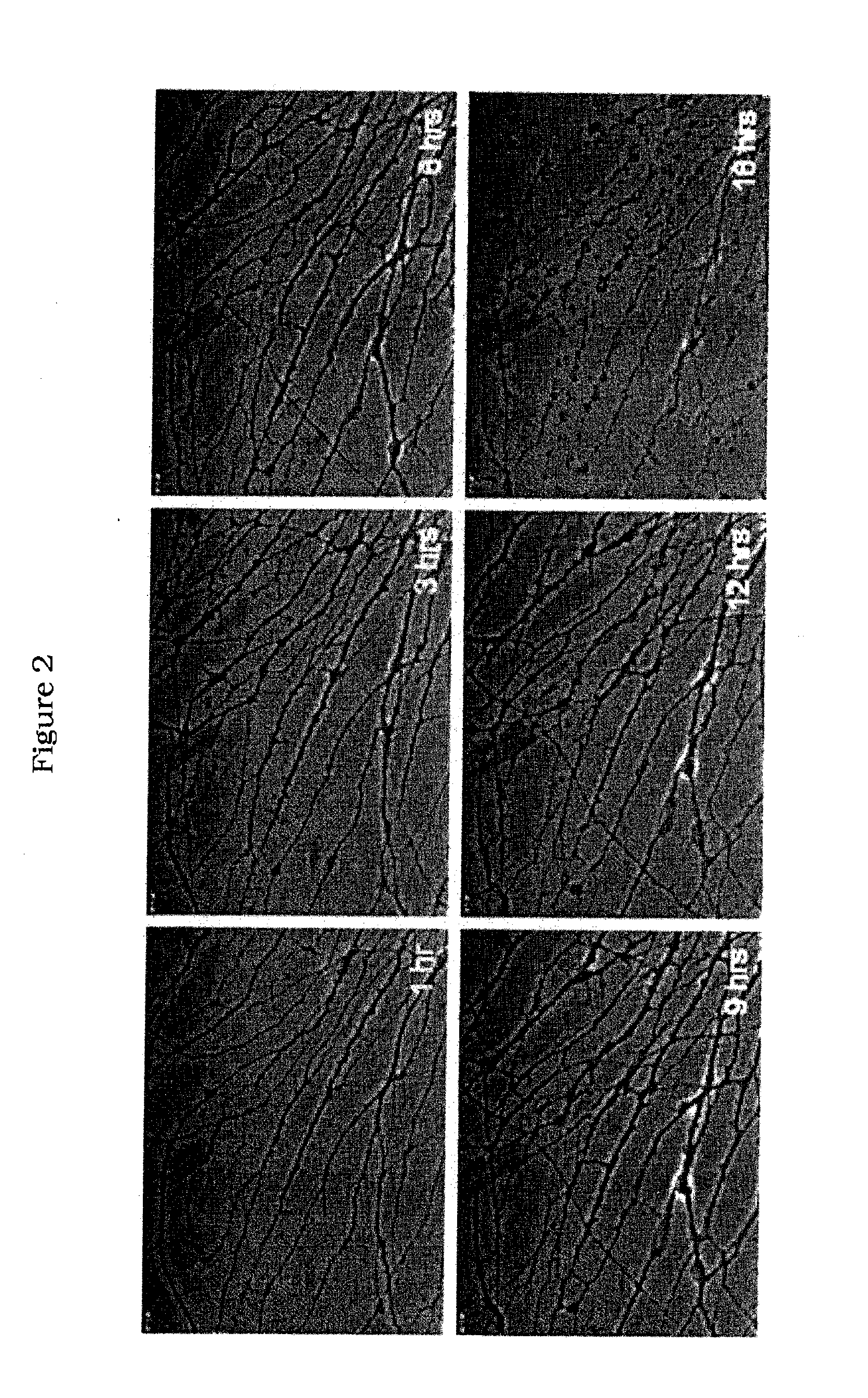 Modulation of Axon Degeneration