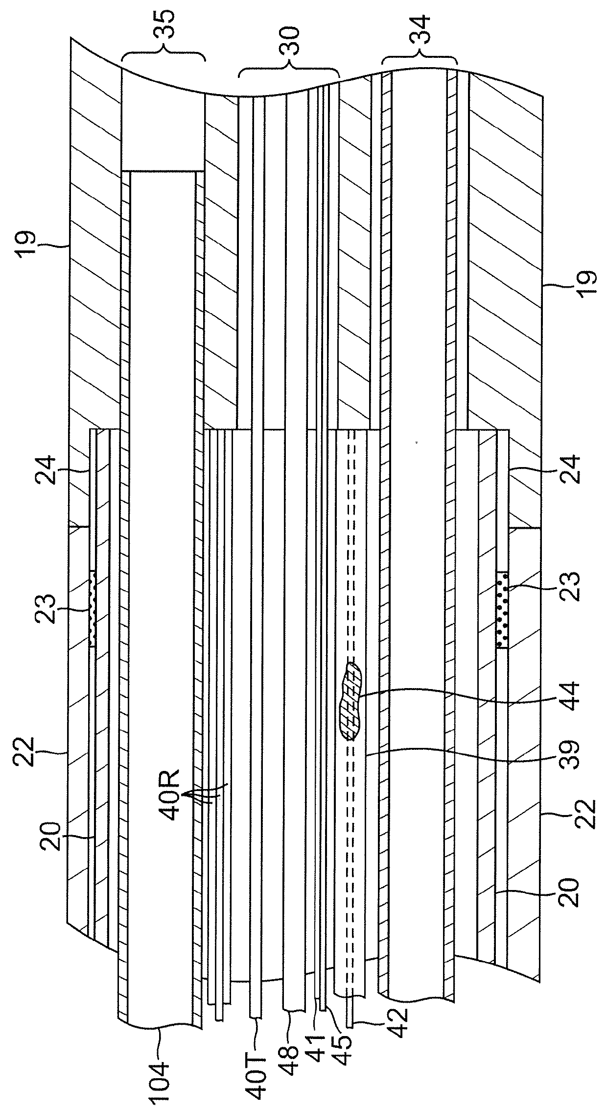 Irrigated catheter with fluid evacuation