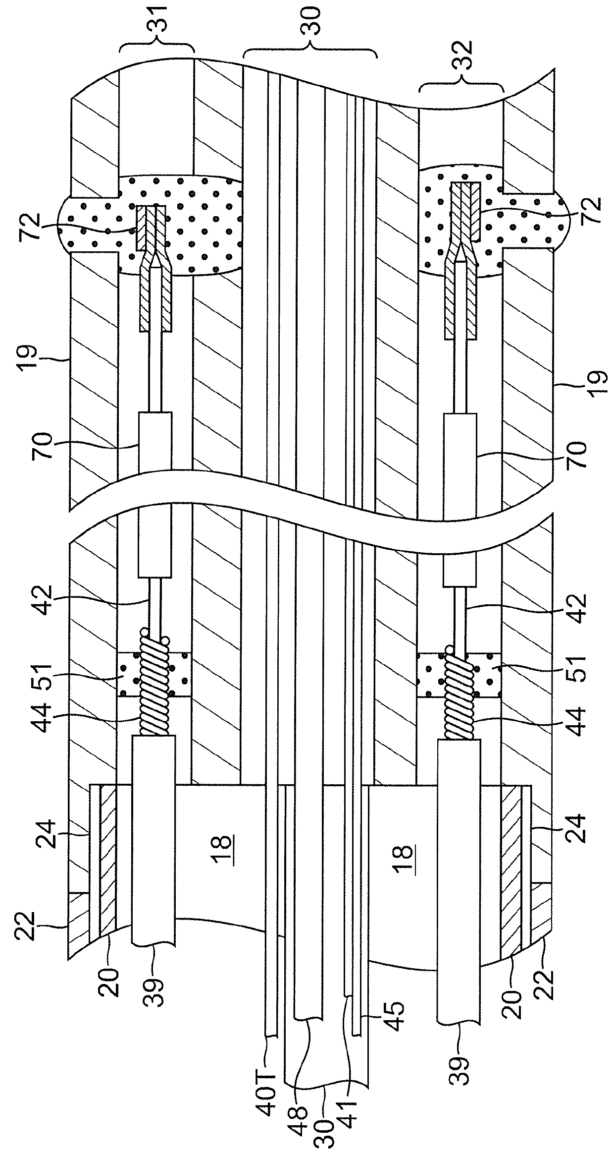 Irrigated catheter with fluid evacuation