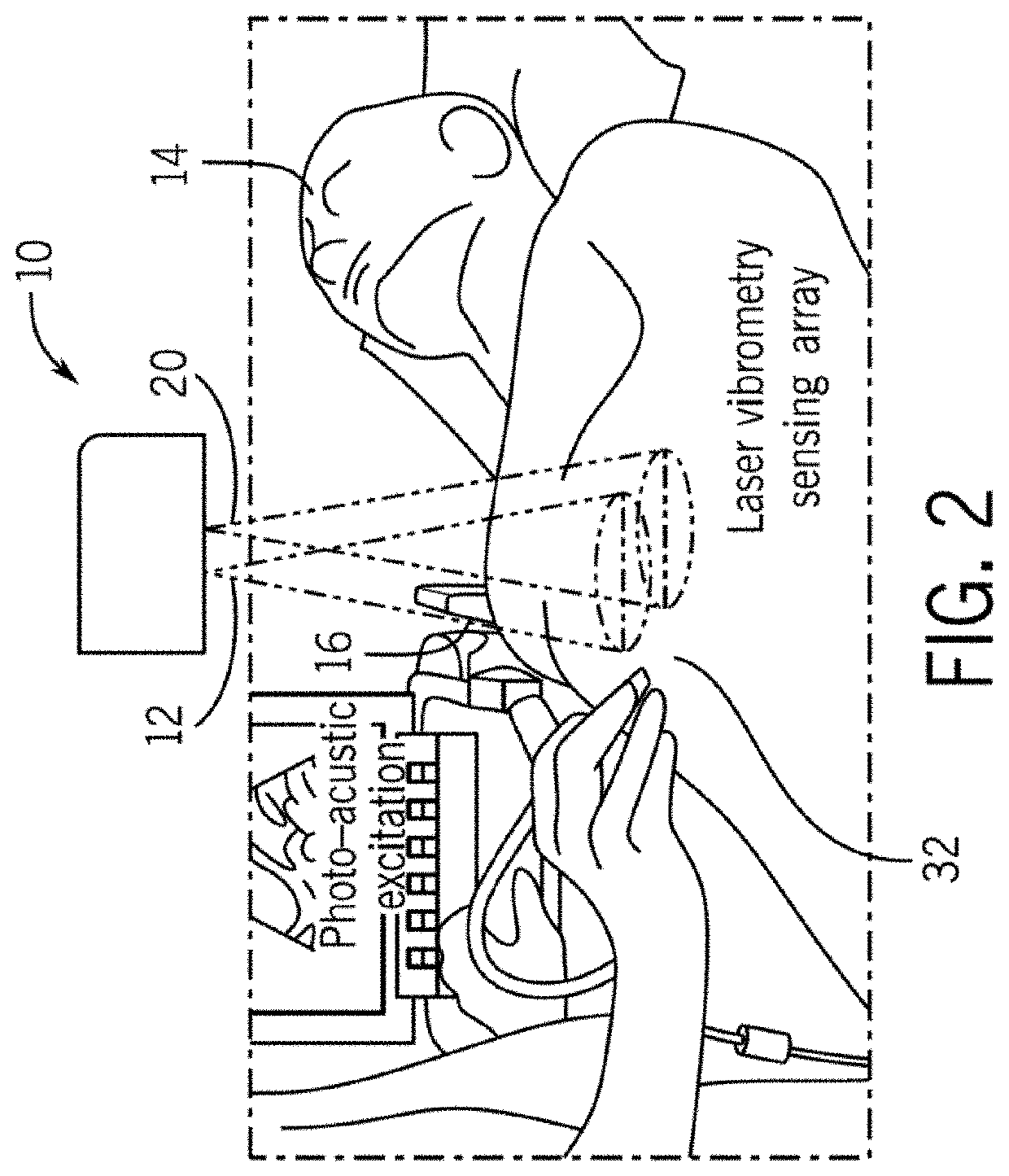 System and method for non-contact ultrasound image reconstruction