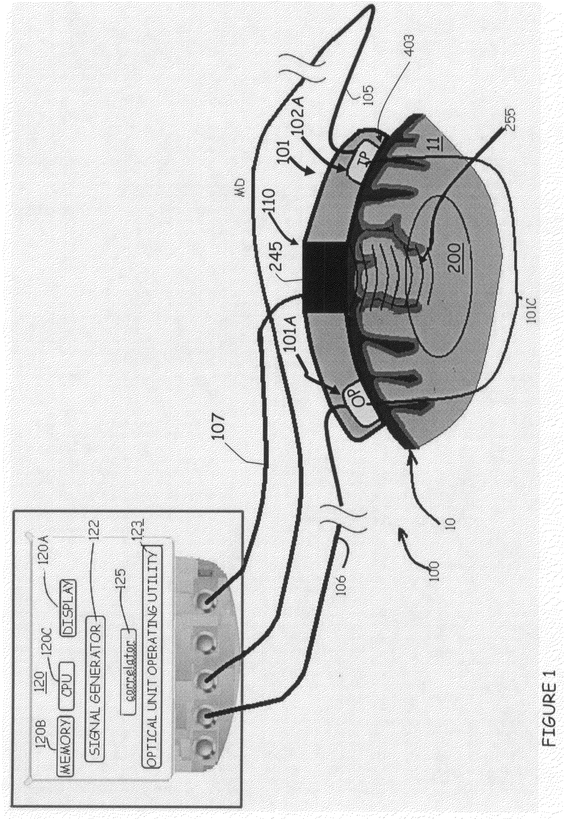 System and method for noninvasively monitoring conditions of a subject