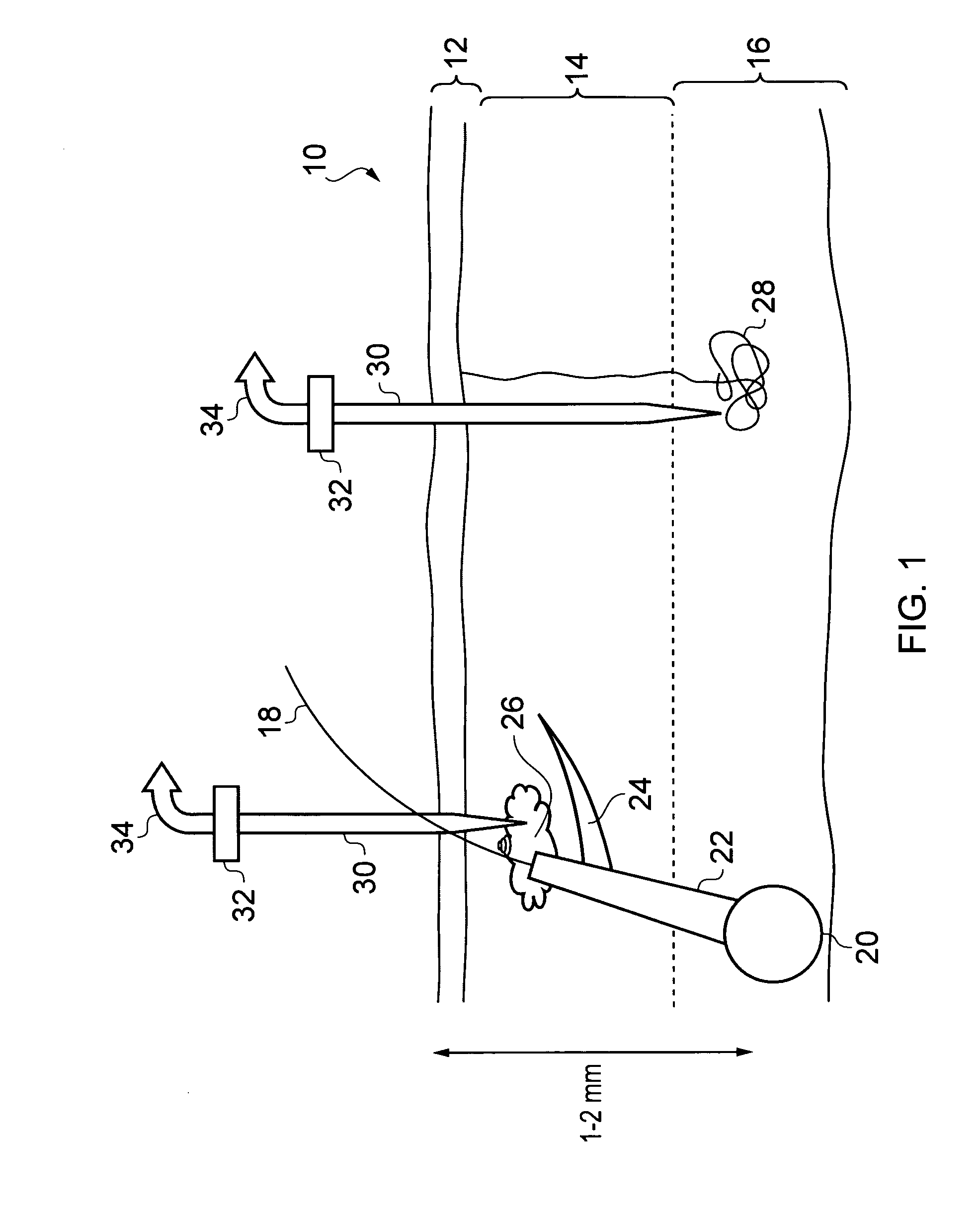 Apparatus for localised invasive skin treatment using electromagnetic radiation