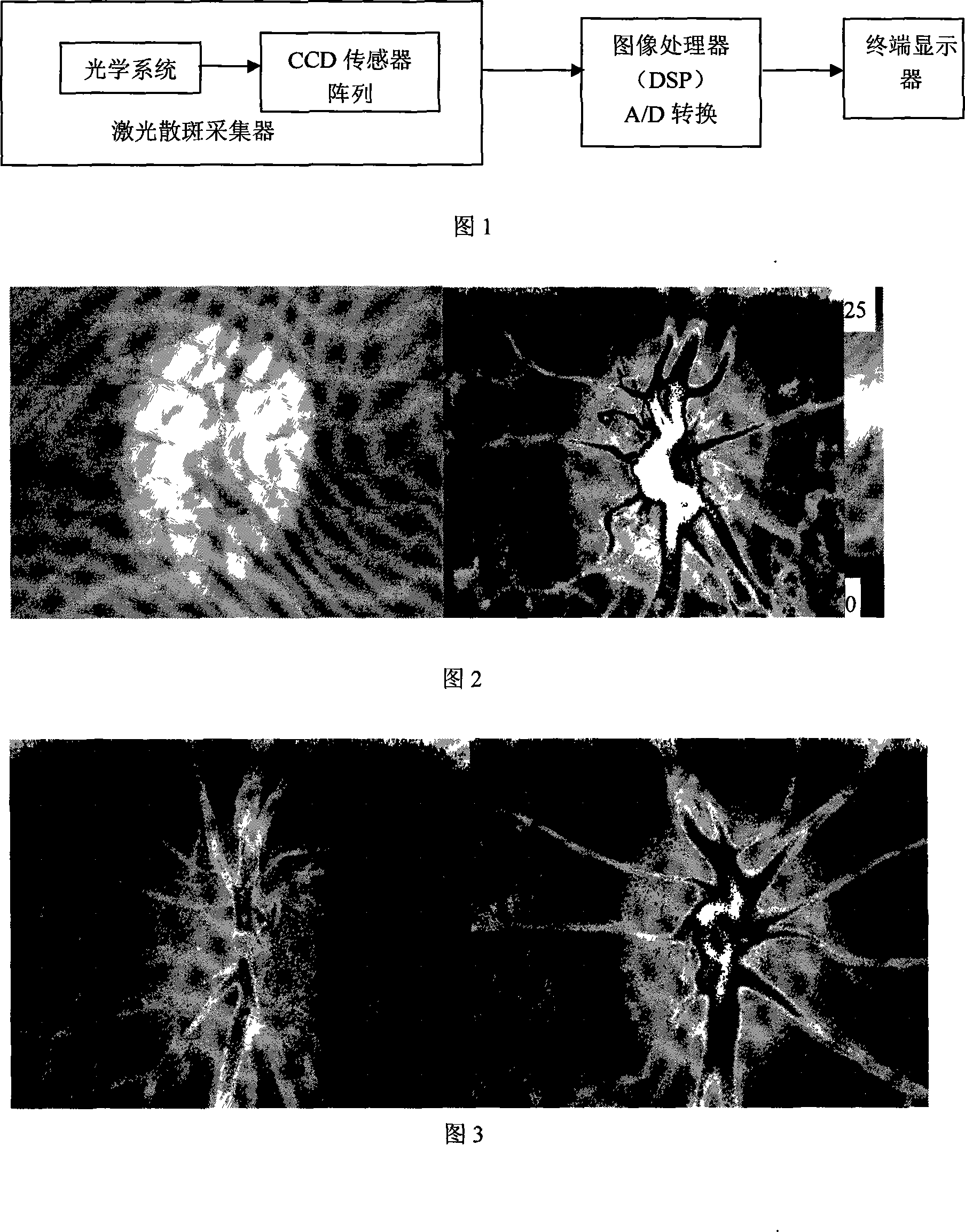 A instrument of laser speckle eyeground blood flow measurement