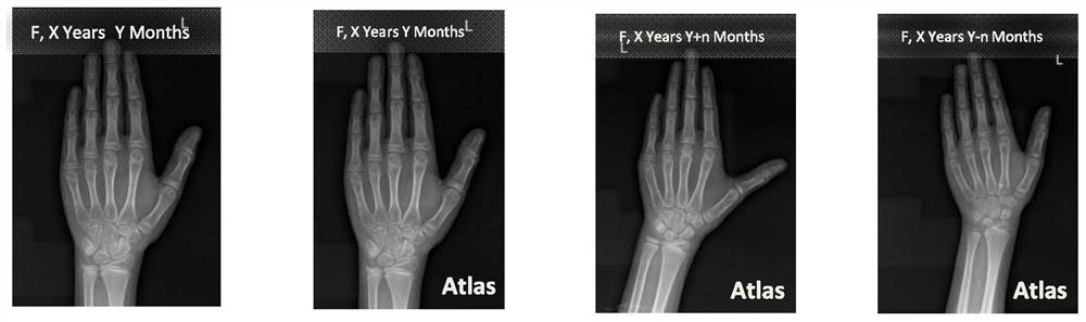 X-ray medical imaging method and system and computer storage medium