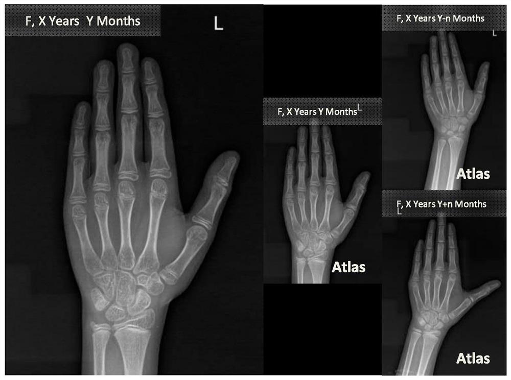 X-ray medical imaging method and system and computer storage medium