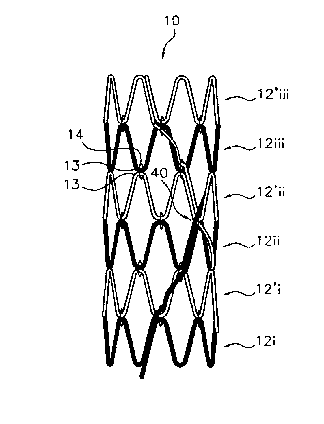 Flexible endoluminal stent and process of repairing a body lumen