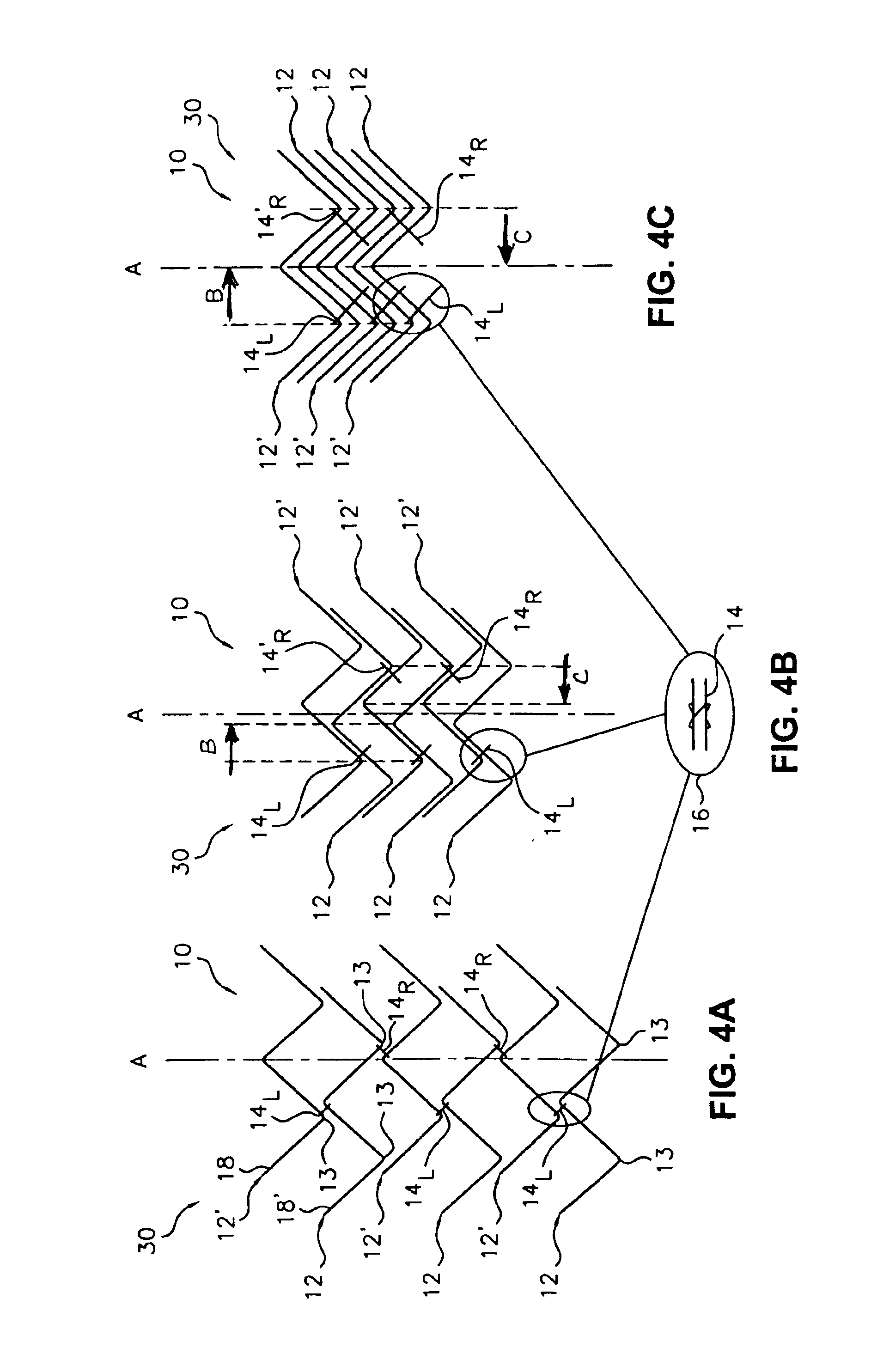 Flexible endoluminal stent and process of repairing a body lumen