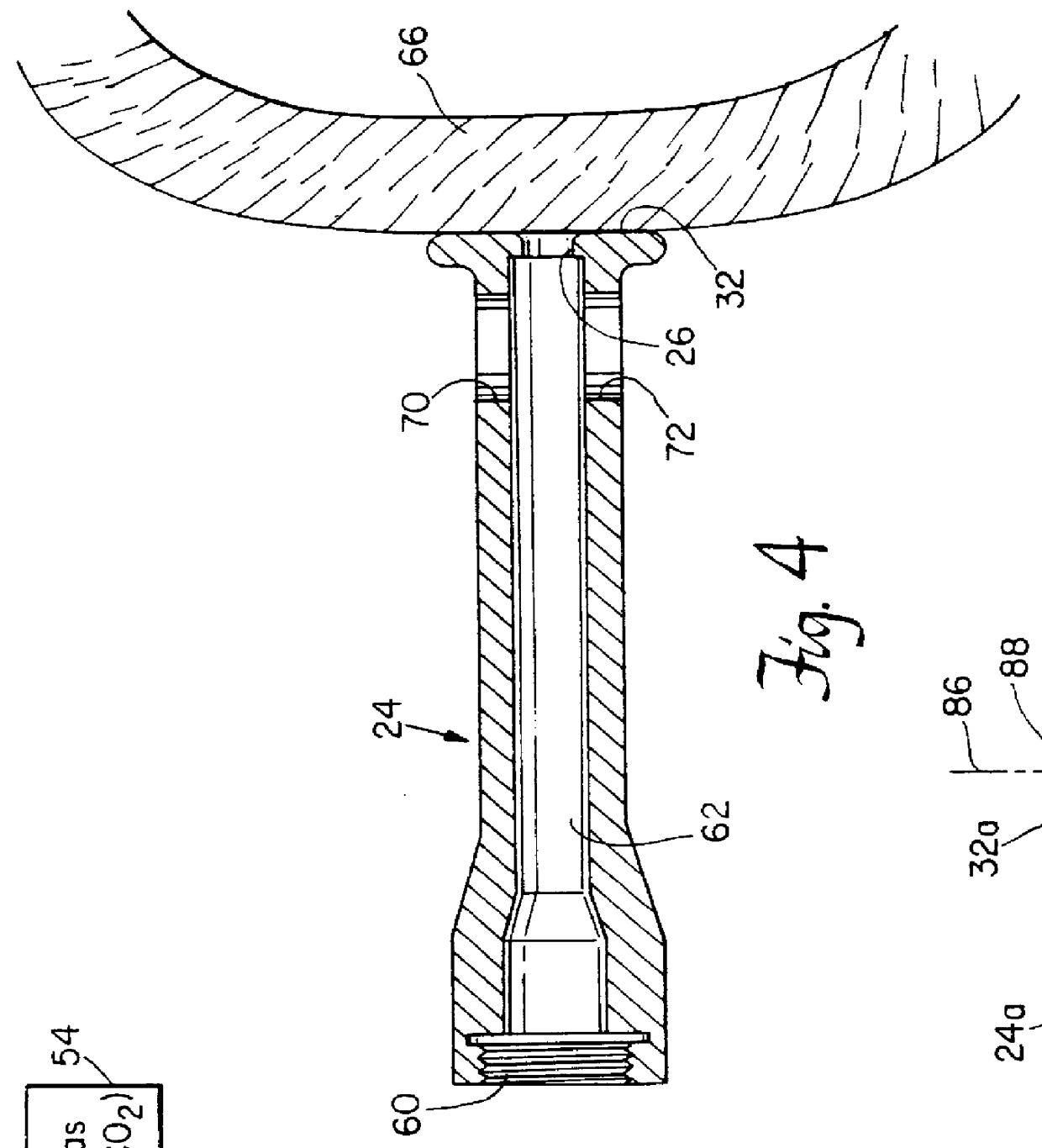 Handpiece for transmyocardial vascularization heart-synchronized pulsed laser system