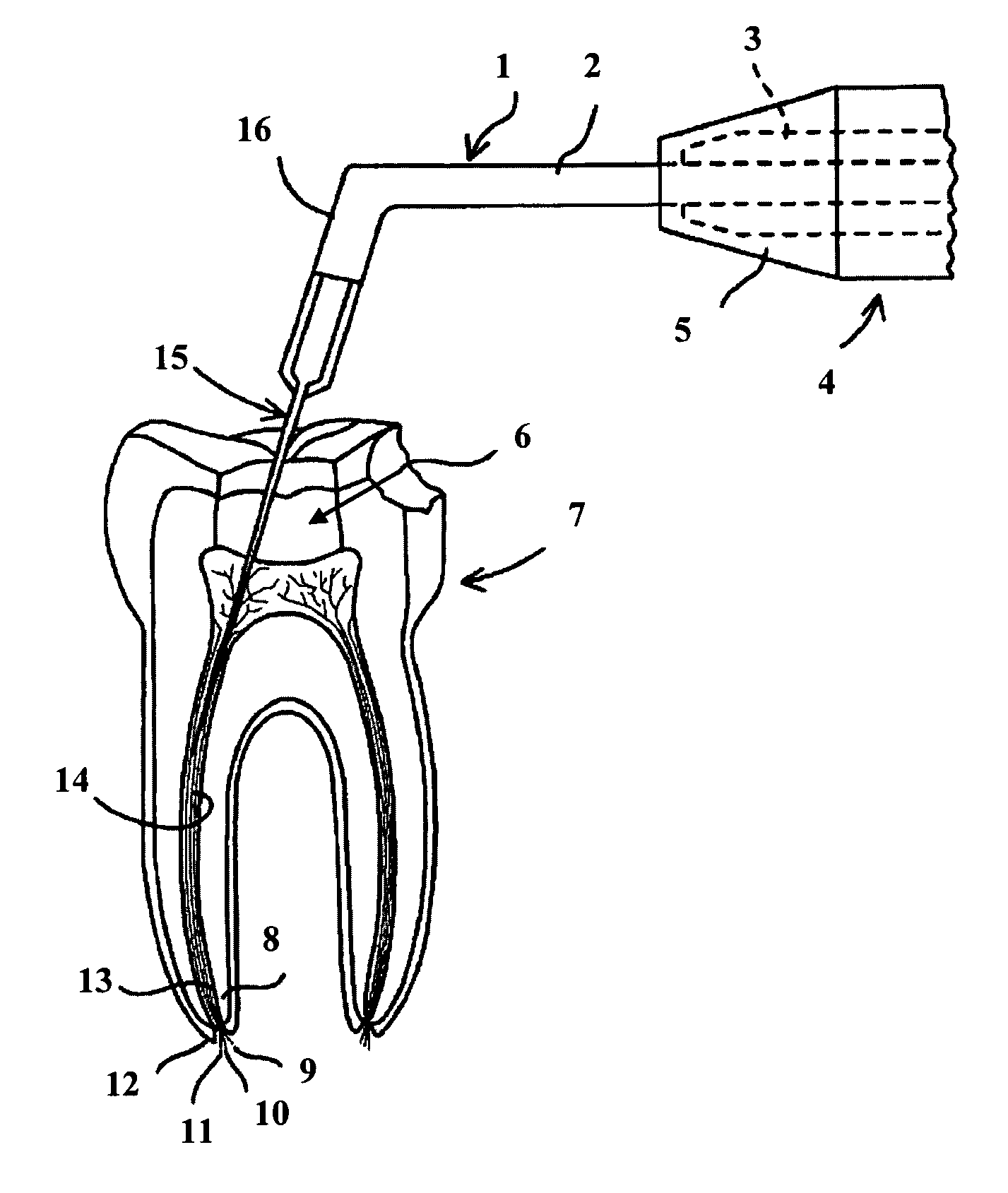 Apparatus and methods for determining the location of the apex of a dental root canal