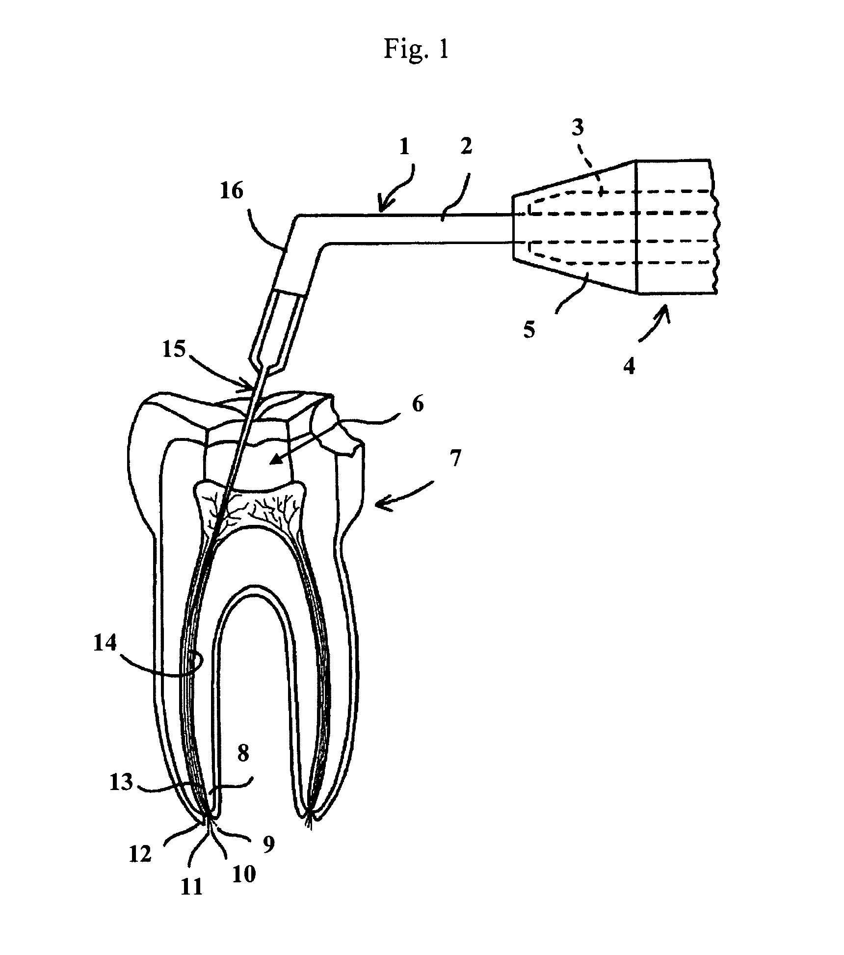 Apparatus and methods for determining the location of the apex of a dental root canal