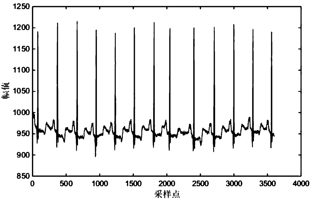 Automatic ECG diagnostic system and device for premature beats