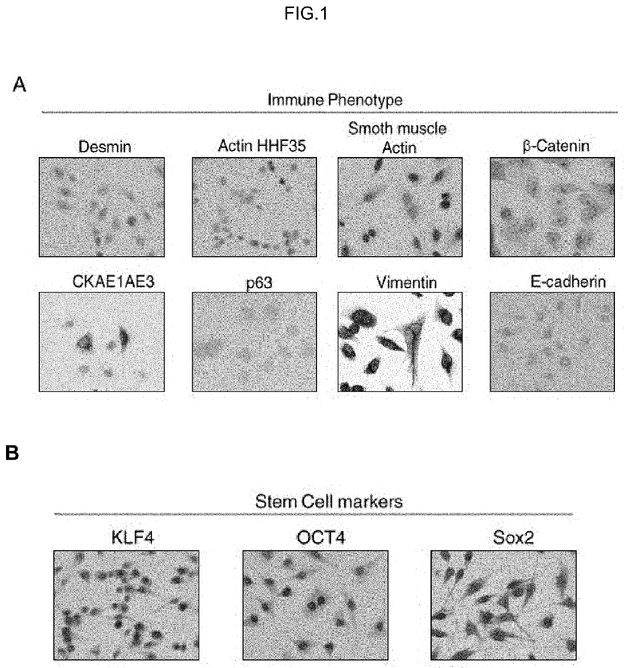 Human uterine cervical stem cell population and uses thereof