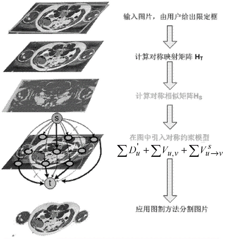 A Segmentation Method of Symmetrical Organs in Medical Images