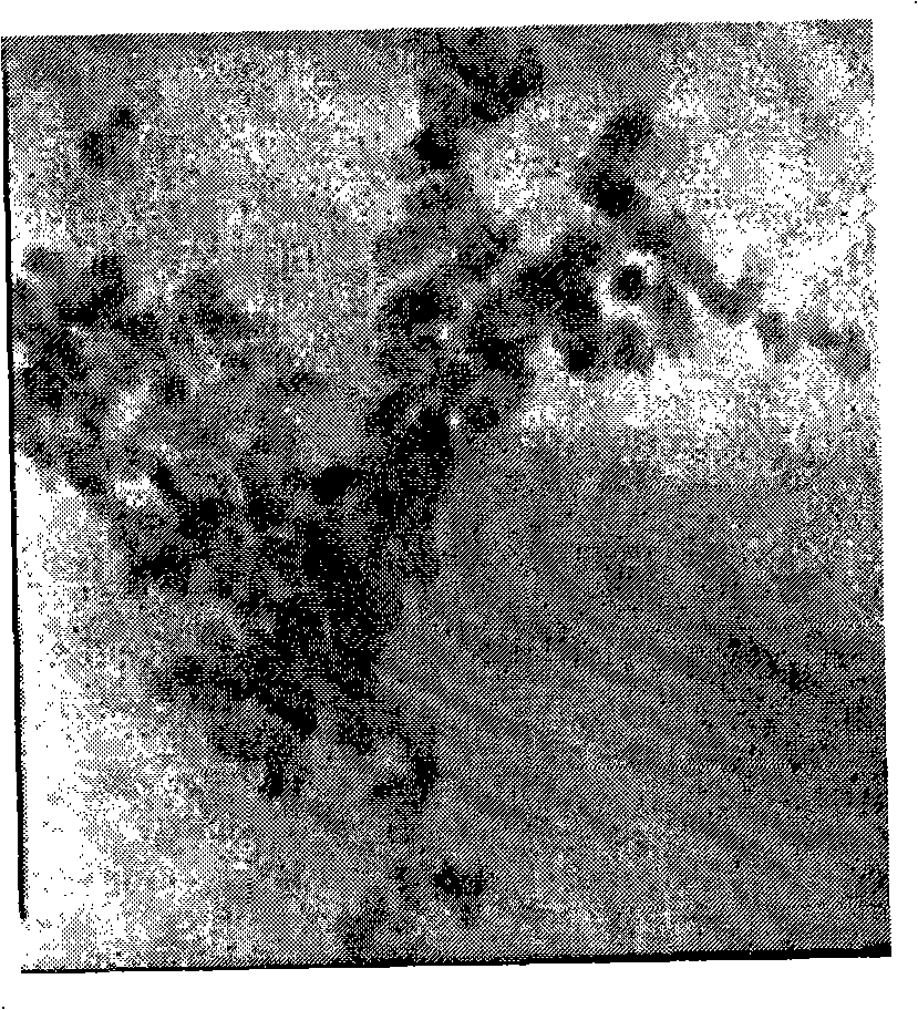 Method for preparing high dispersibility nano-hydroxyapatite