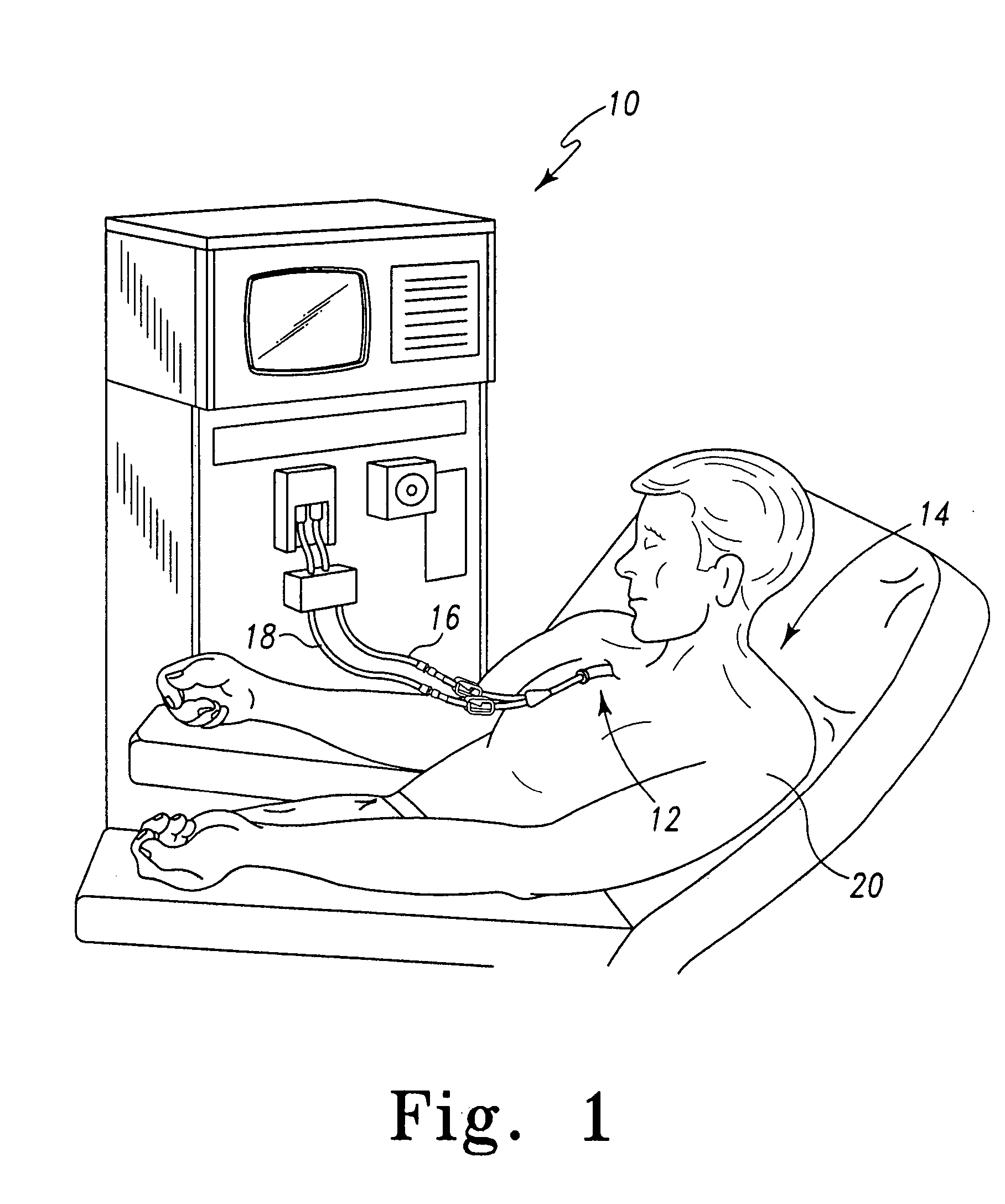 Methods of performing medical procedures with catheter systems having movable member