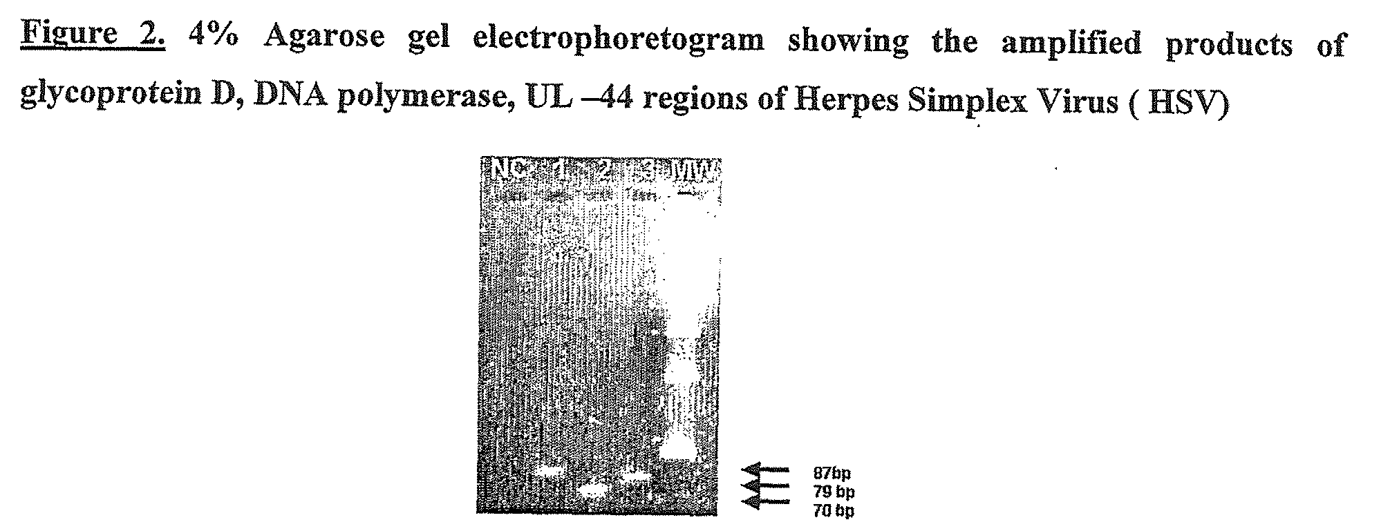 Novel method for simultaneous detection and discrimination of bacterial, fungal, parasitic and viral infections of eye and central nervous system