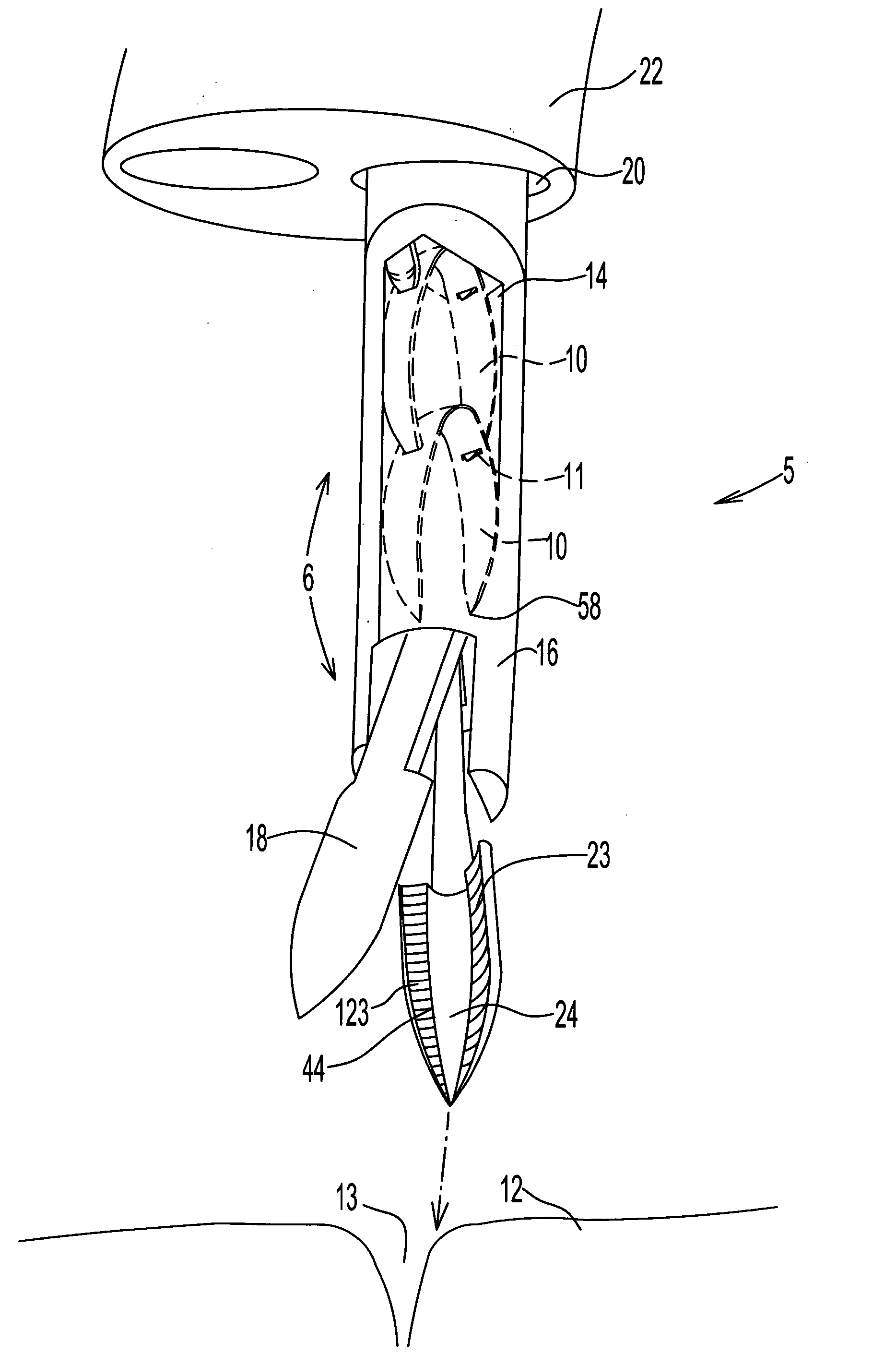 Endoscopic fastening system with multiple fasteners