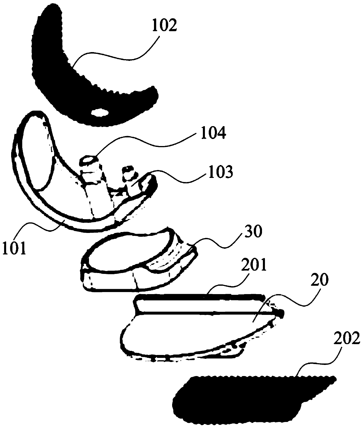 Single-compartment knee joint prosthesis and manufacturing method thereof