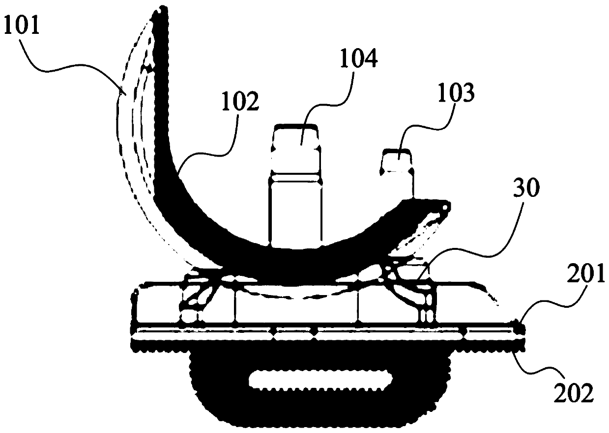 Single-compartment knee joint prosthesis and manufacturing method thereof