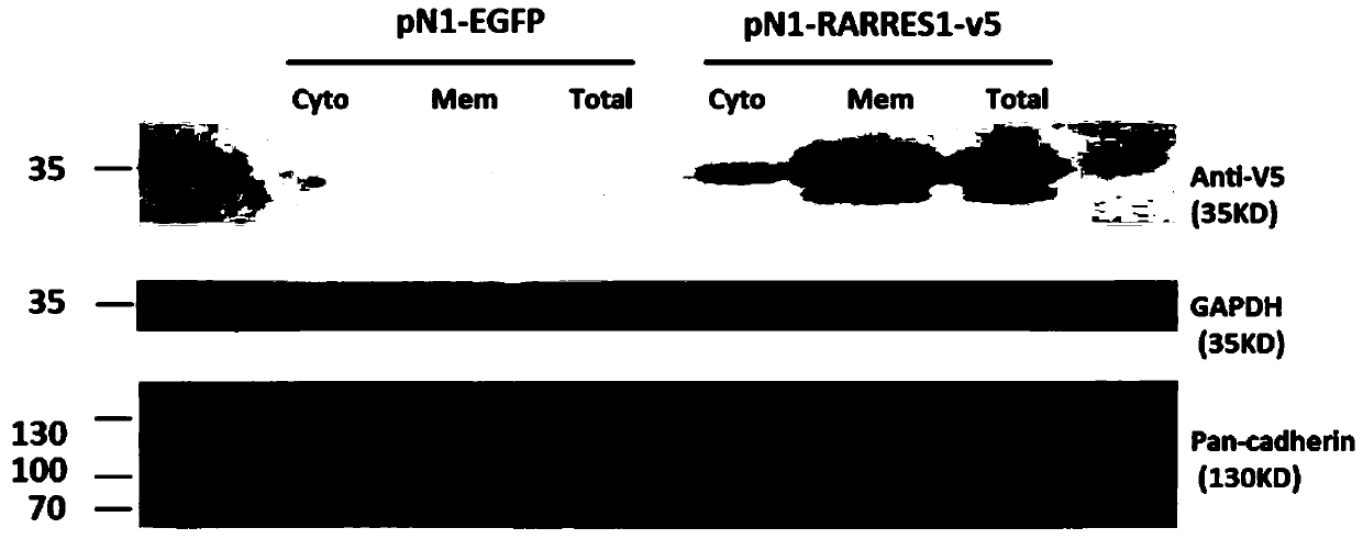 Application of retinoic acid receptor reactive protein 1 as biomarker in chronic kidney disease