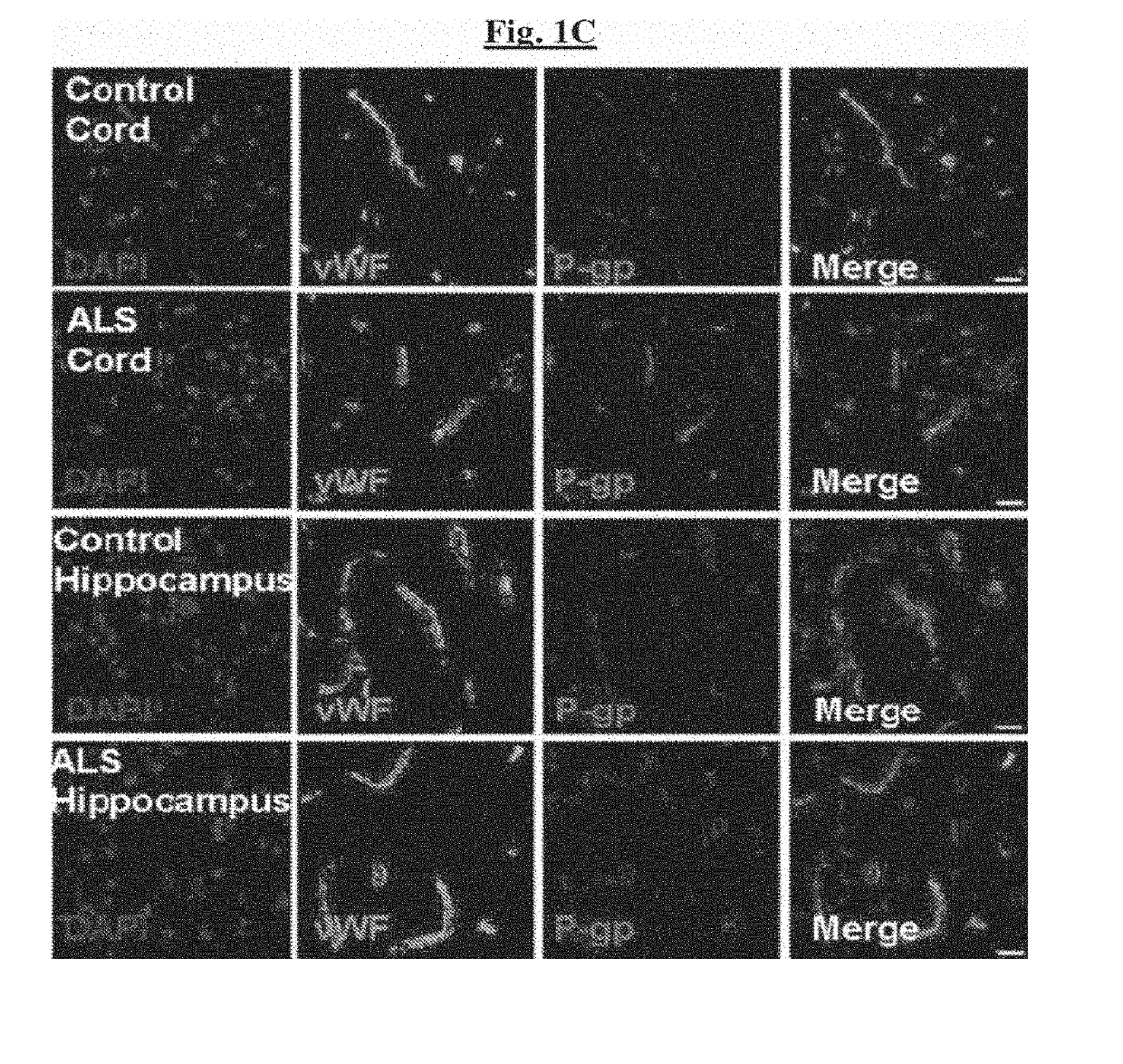 Novel methods of treating a neurodegenerative disease in a mammal in need thereof