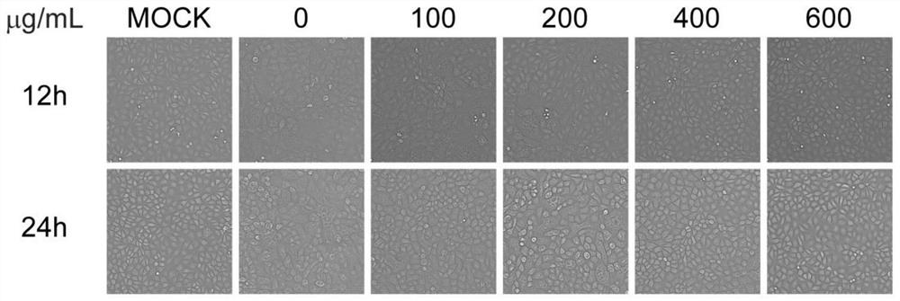 Application of plantain herb polysaccharide in preparation of preparation for resisting porcine pseudorabies virus infection