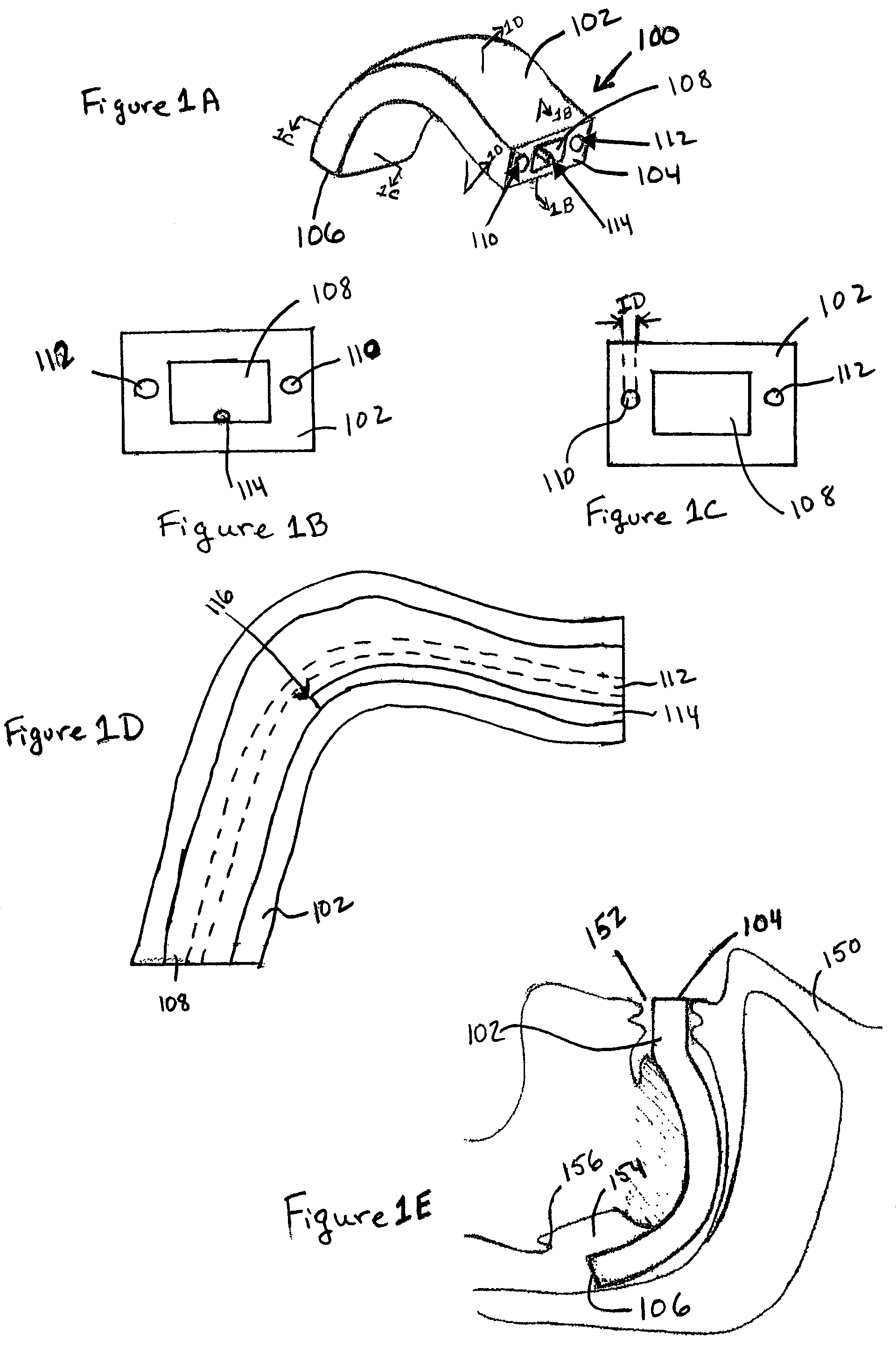 Oropharyngeal airway