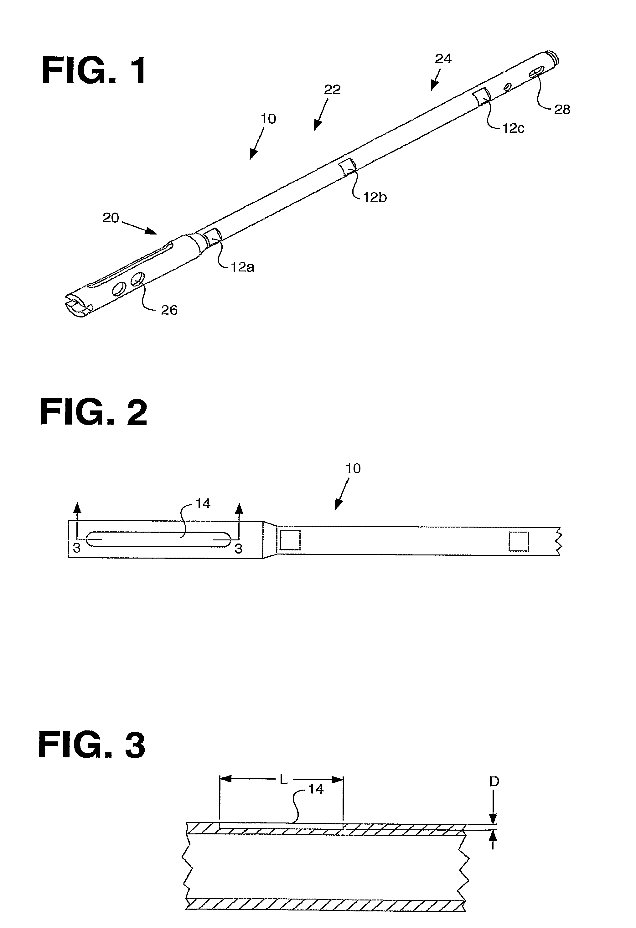 Processing sensed accelerometer data for determination of bone healing