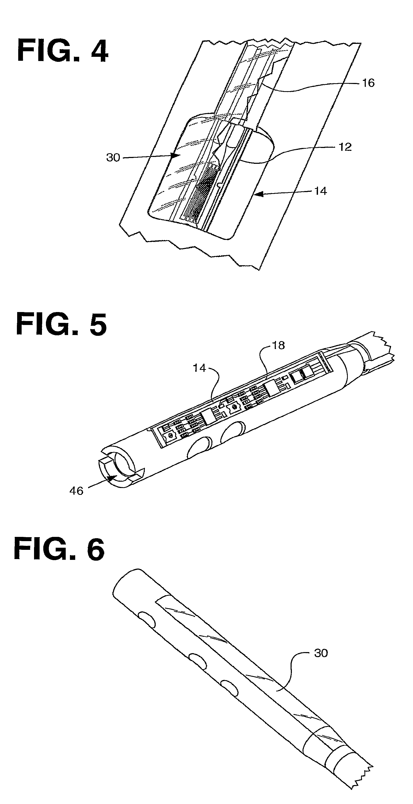 Processing sensed accelerometer data for determination of bone healing