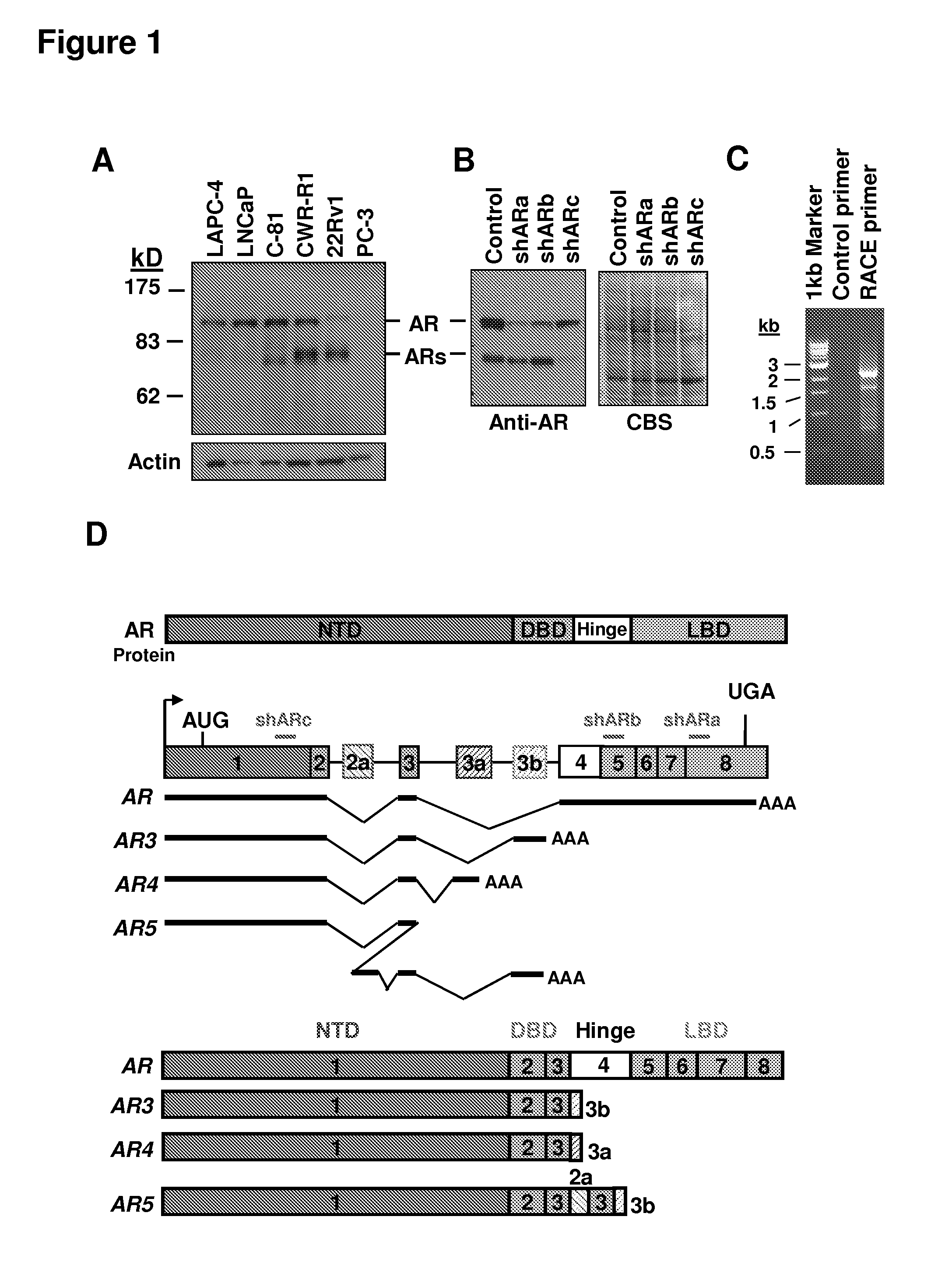 Human androgen receptor alternative splice variants