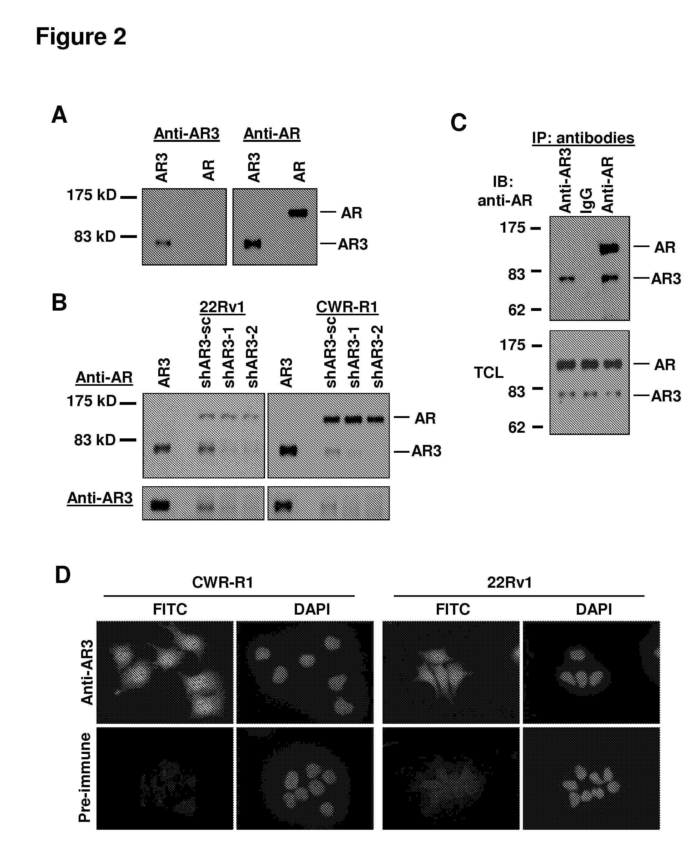 Human androgen receptor alternative splice variants