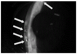 Application of cornea surface protection agent in general anaesthesia operations