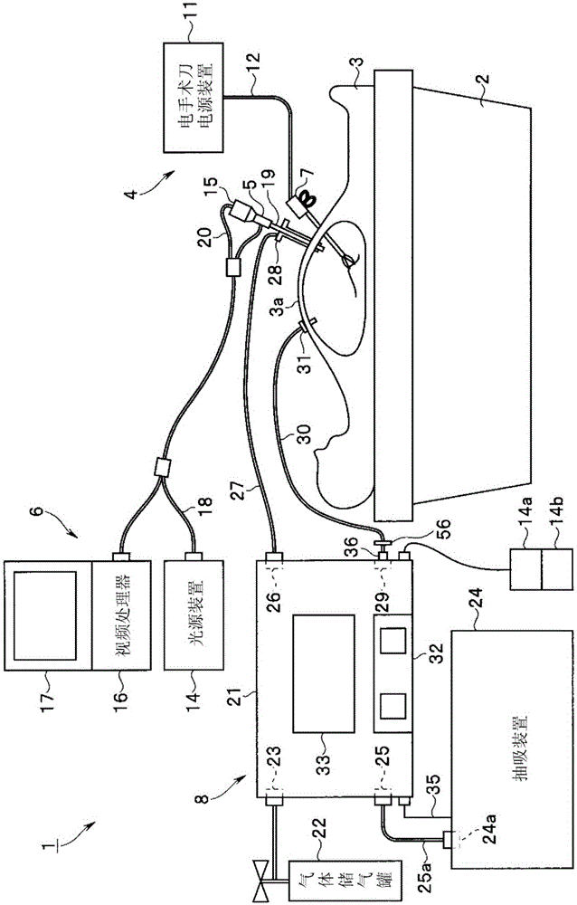 Pneumoperitoneum apparatus