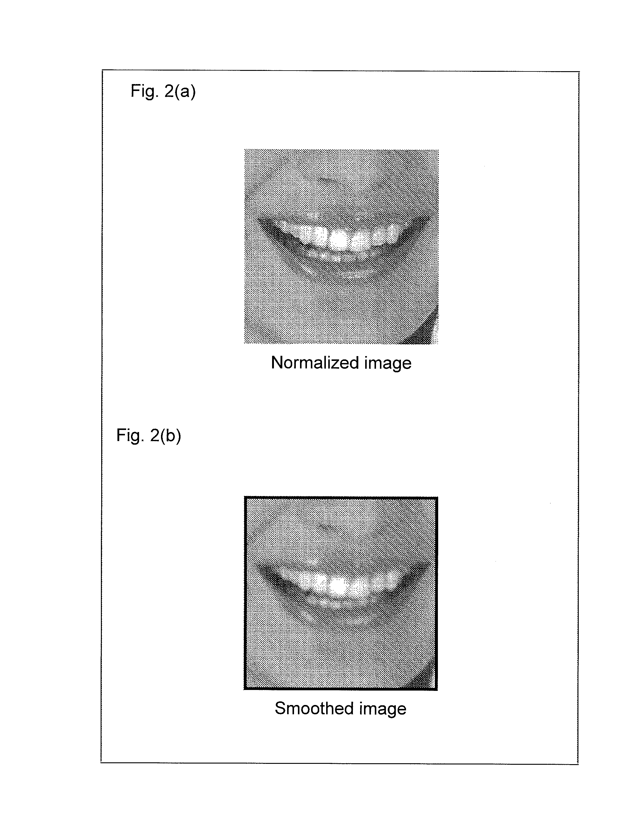 Image processing device, image processing method, and control program