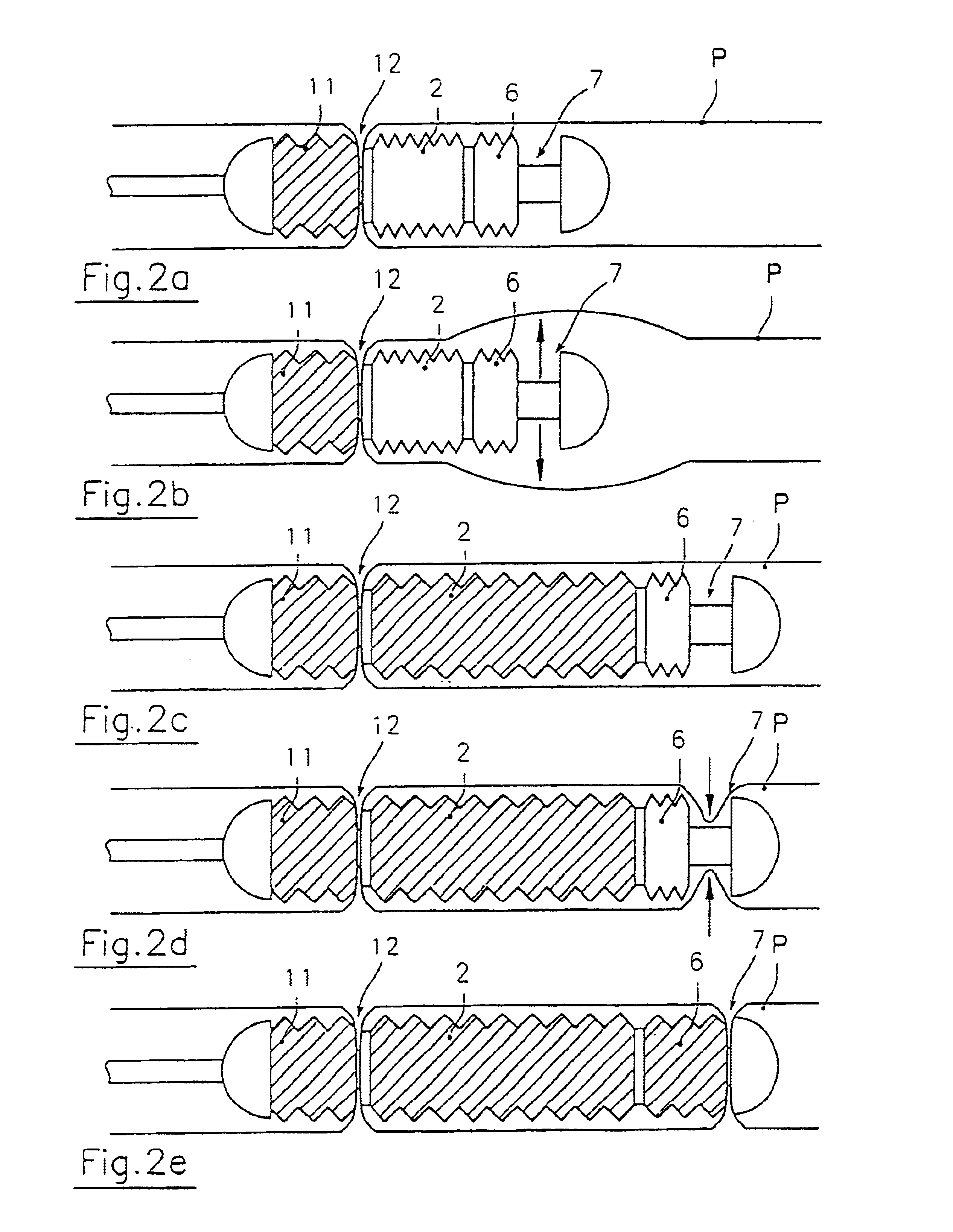 Endoscopic device for locomotion through the gastro-intestinal tract