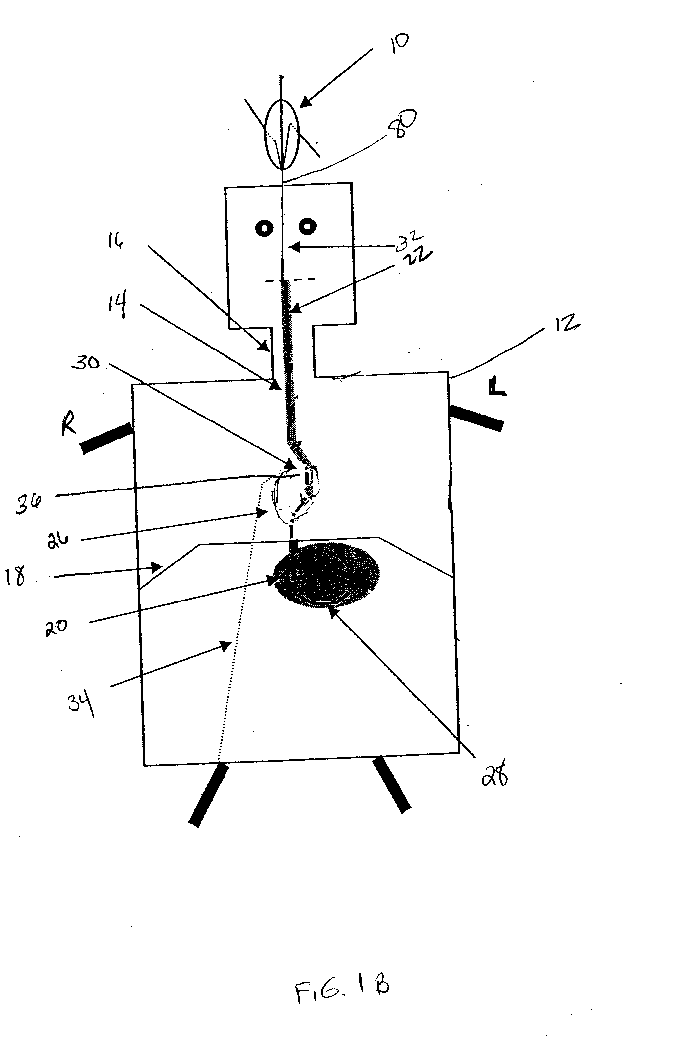 System and method for influencing an anatomical structure