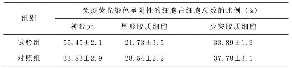 Nerve stem cell special-purpose culture medium and culture method thereof