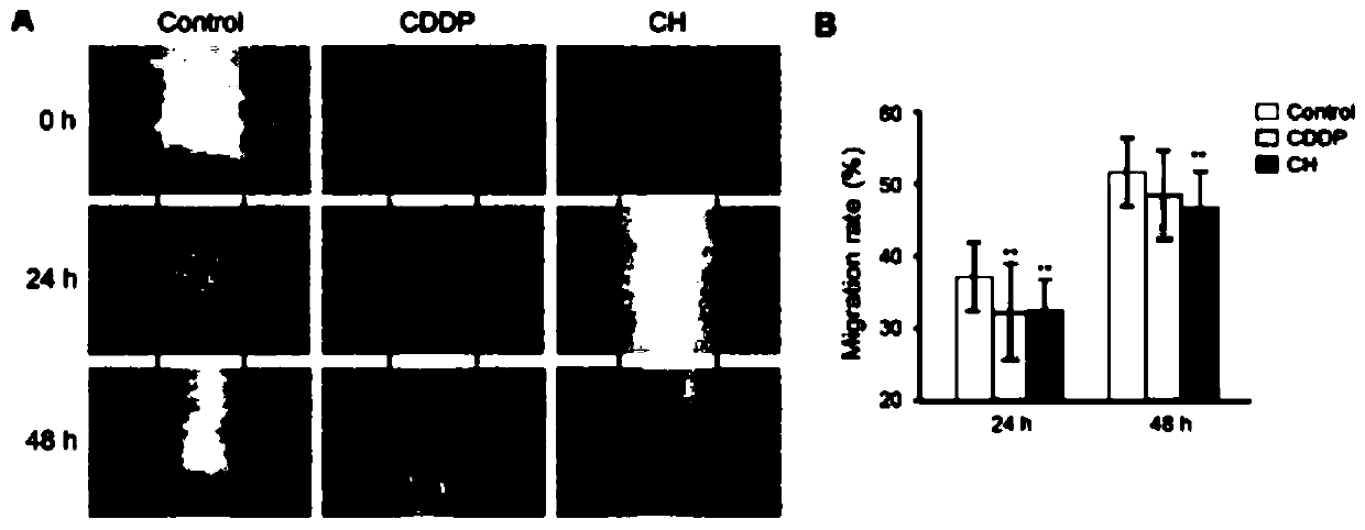 Application of combined stephanine and autophagy inhibitor for preparing drugs for treating liver cancer